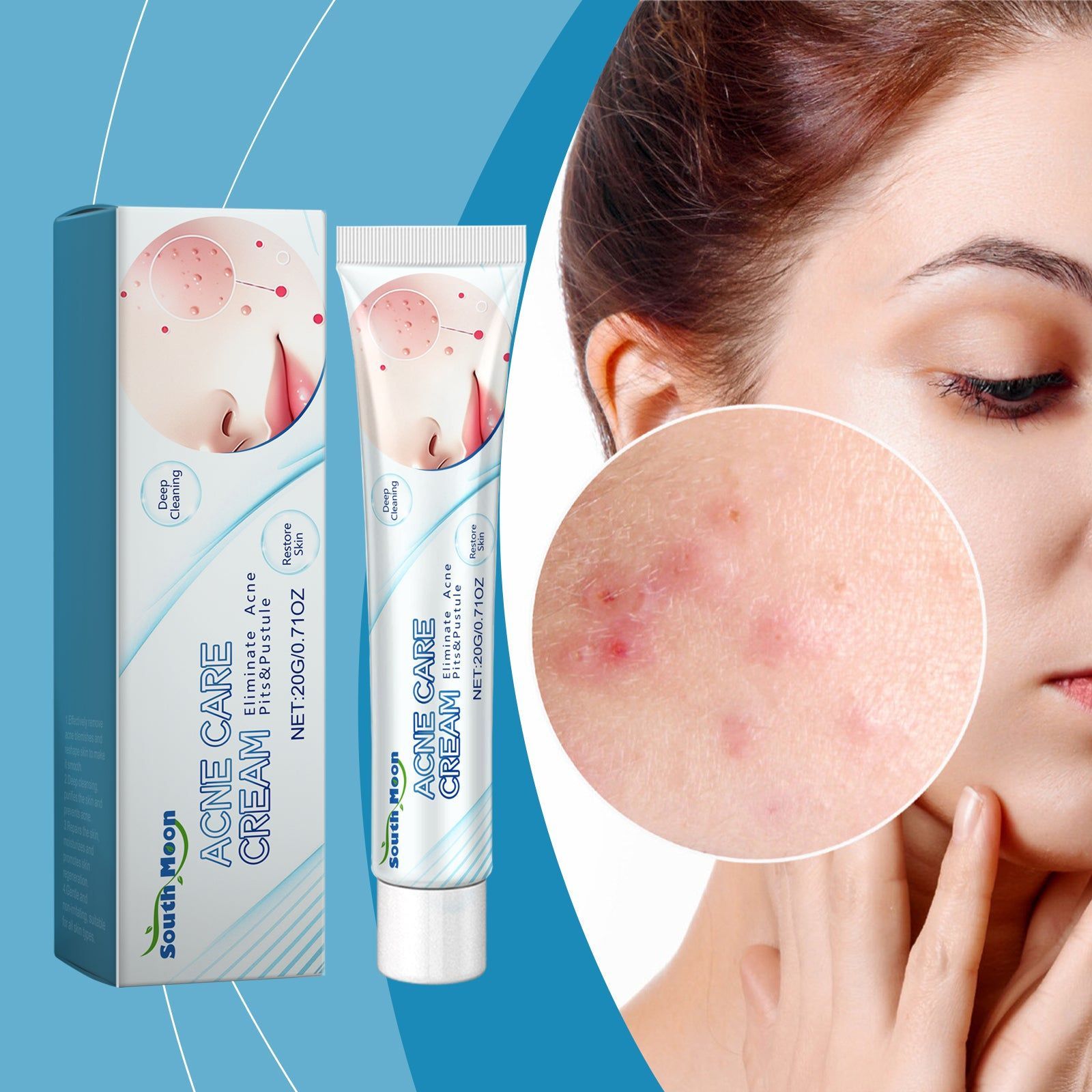 Clear Acne Marks Fast, Acne Repair Cream for Flawless Skin, Pimple Scar Treatment ,20g
