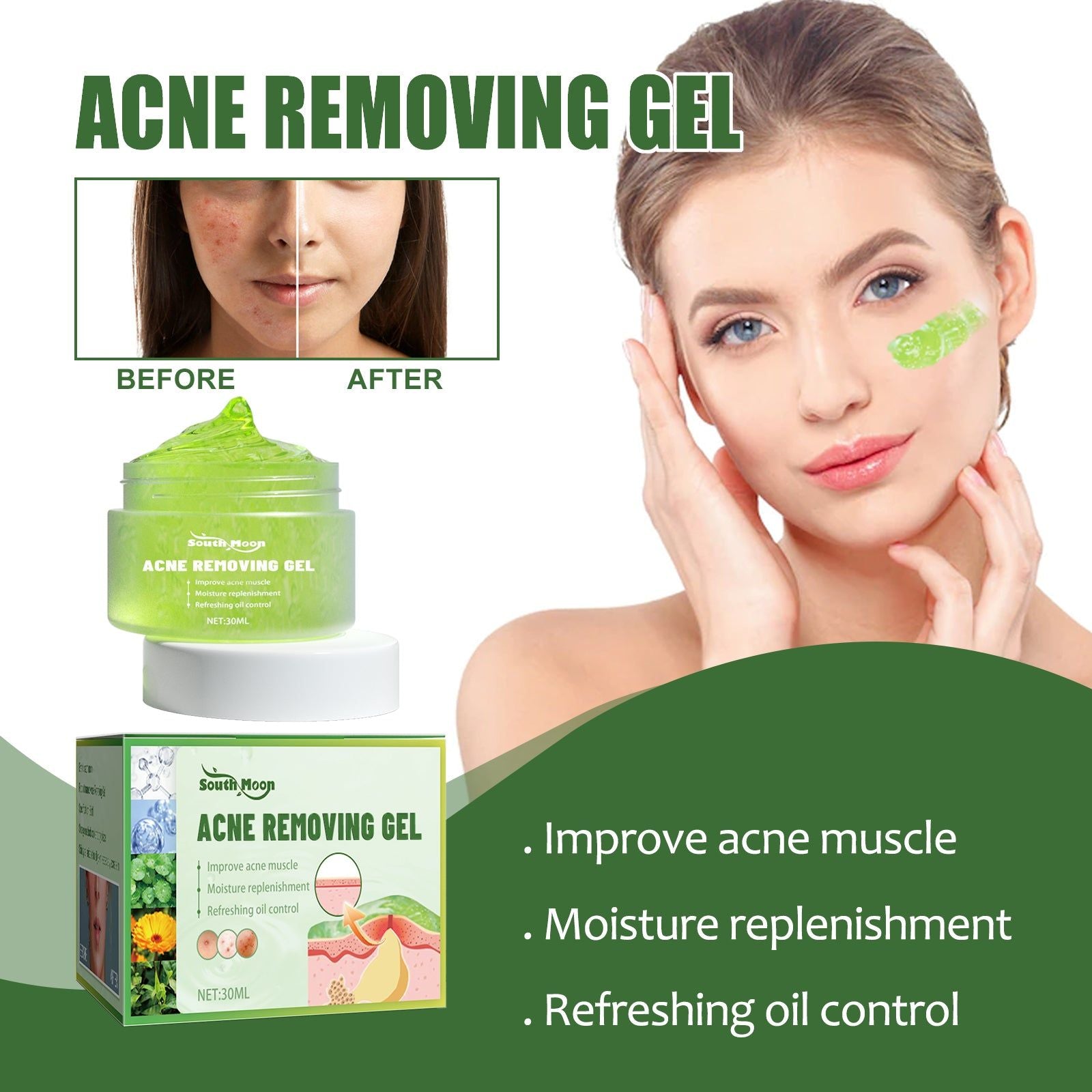 Clear Acne Fast, Deep Clean Skin, Natural Herbal Acne Gel, Oil Control, Pore Shrink ,30ml