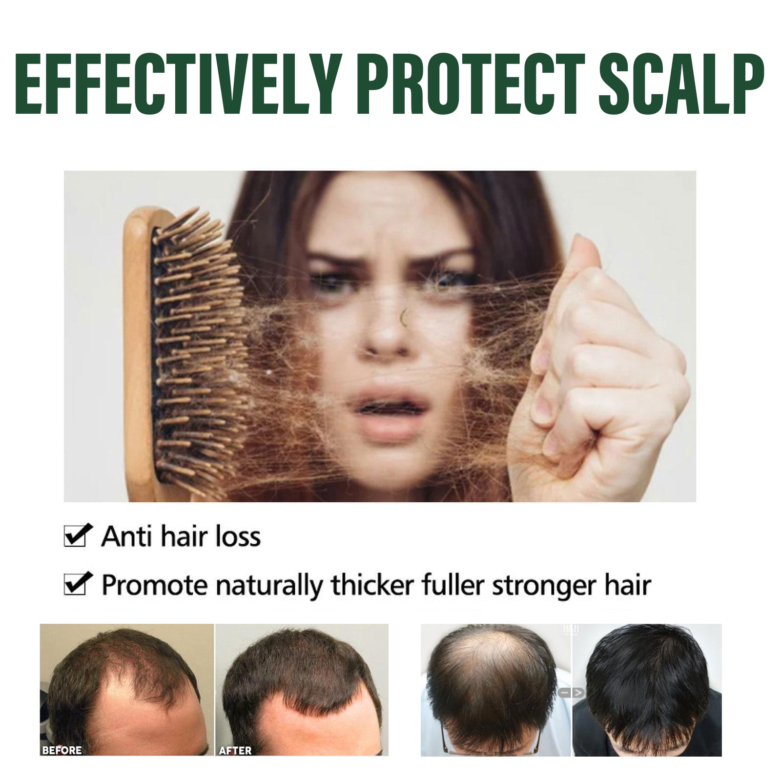 Amla Hair Care Shampoo for Thinning Hair, Nourishing, Strengthening, and Volumizing ,100ml