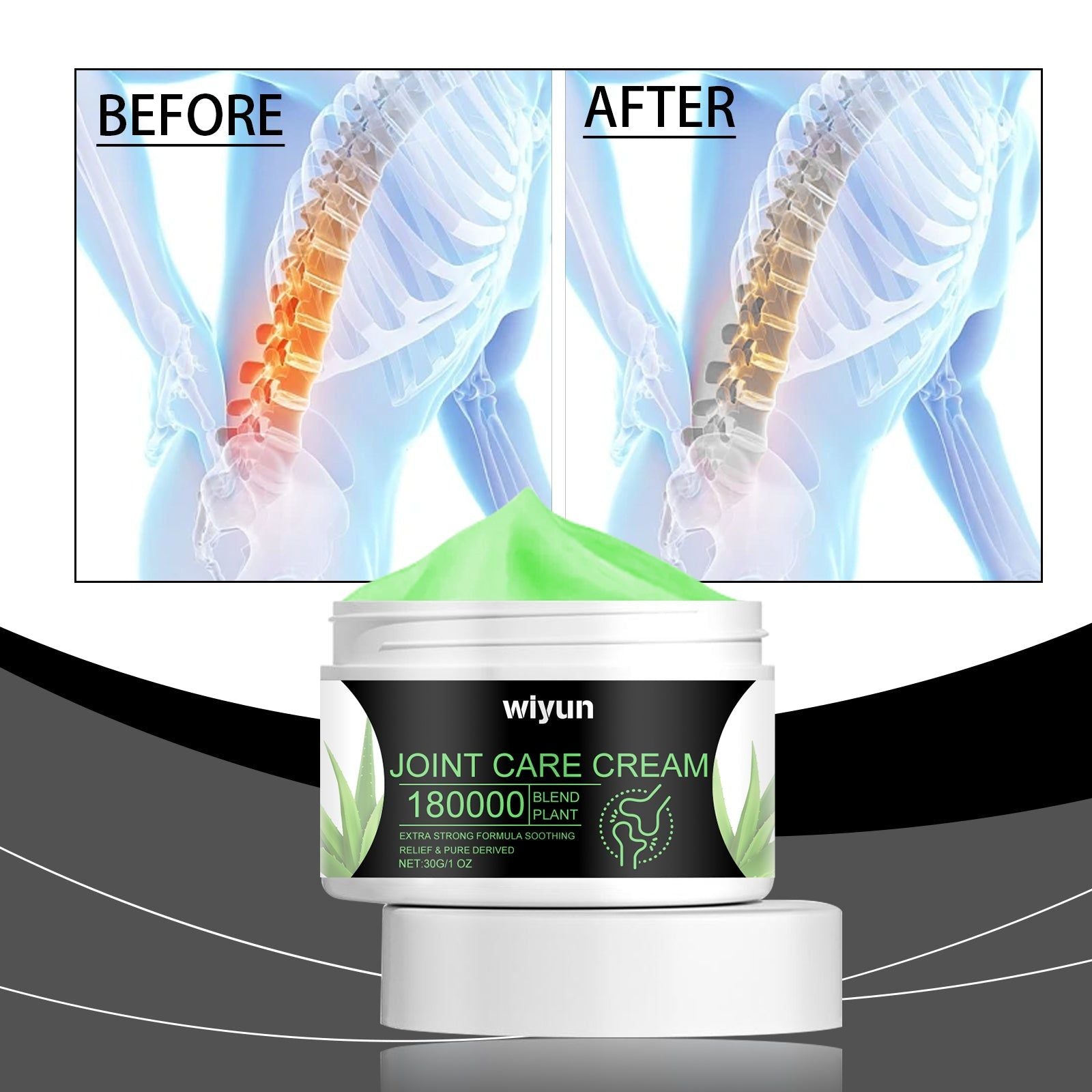 Thermal Acid Joint Care Cream, Fast Relief for Sore Muscles, Blood Circulation, Natural Pain Relief ,30g