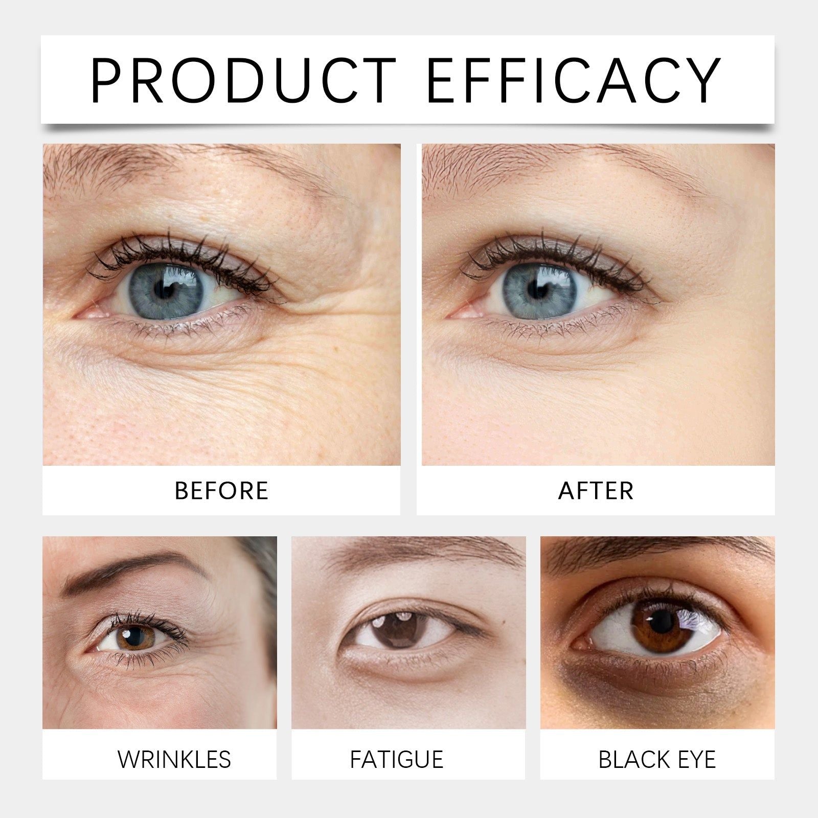 Revitalize Your Eyes with Eye Peptide Cream, Anti-Aging, Brightening, Hydrating, Eye Care ,15g