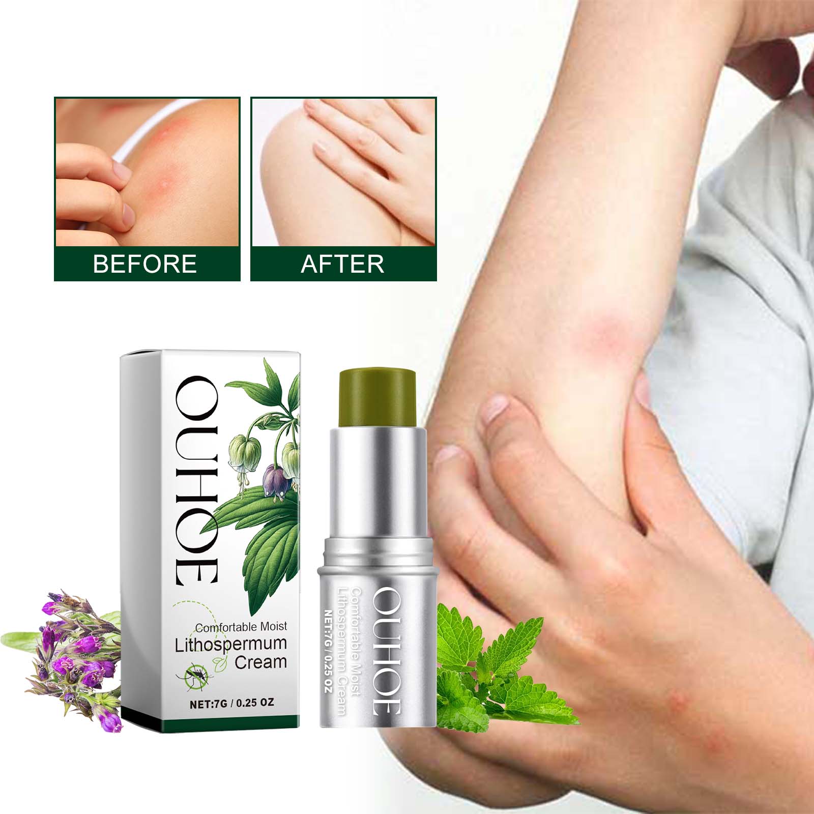 Comfortable Moist Lithospermum Cream, Mosquito Bite Protection, Summer Outdoor Kids, Anti-Insect Relief ,7g