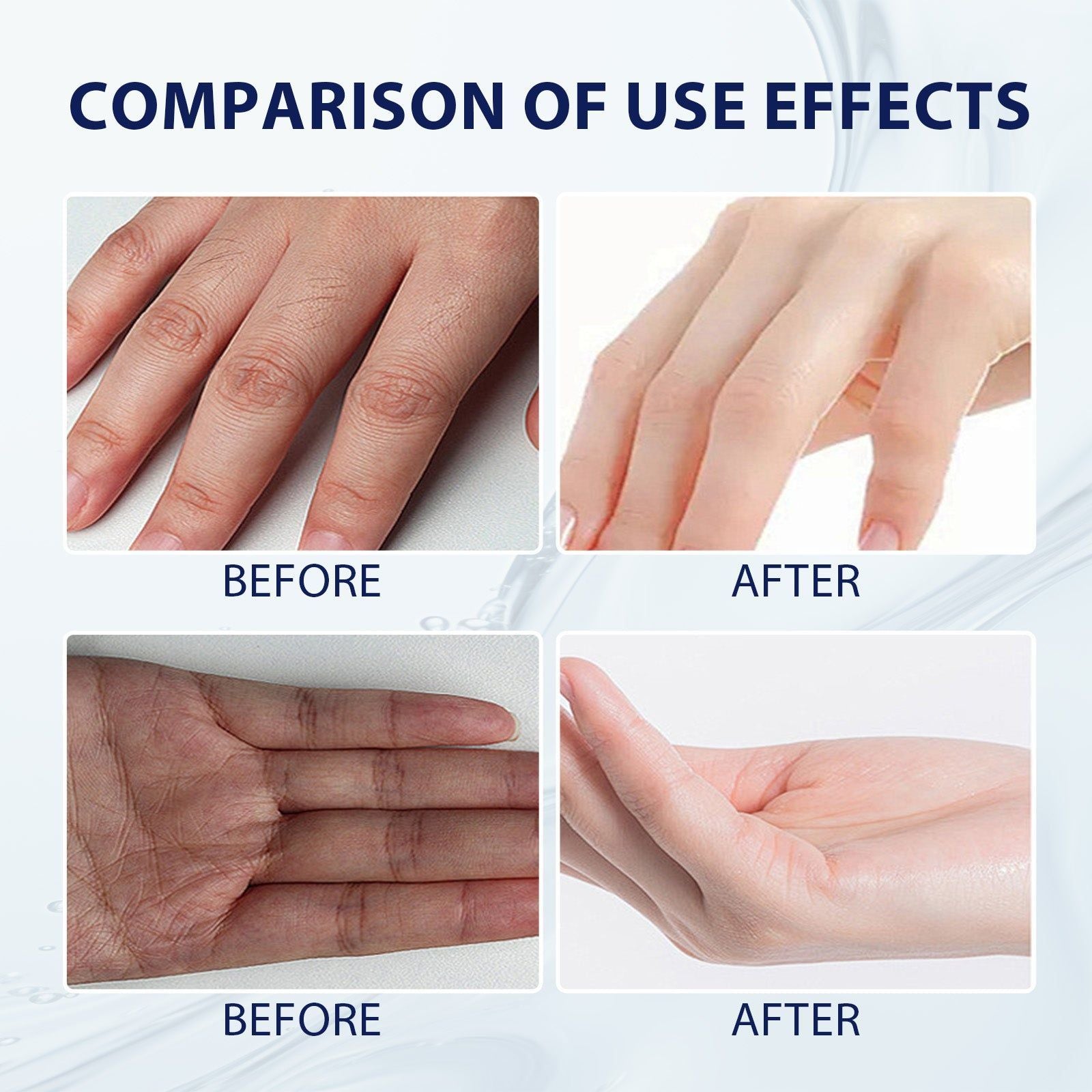 Aloe Vera Hand Care Gel, Hydrating Moisturizer for Dry Skin, Refreshing, Gentle, Daily Hand Hygiene ,100g