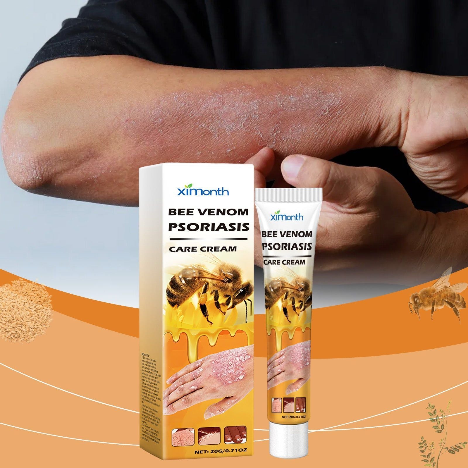 Bee-Venom Moss Care Cream for Skin Repair, Moisturizes, Soothes Itchy Red Hands and Feet ,20g