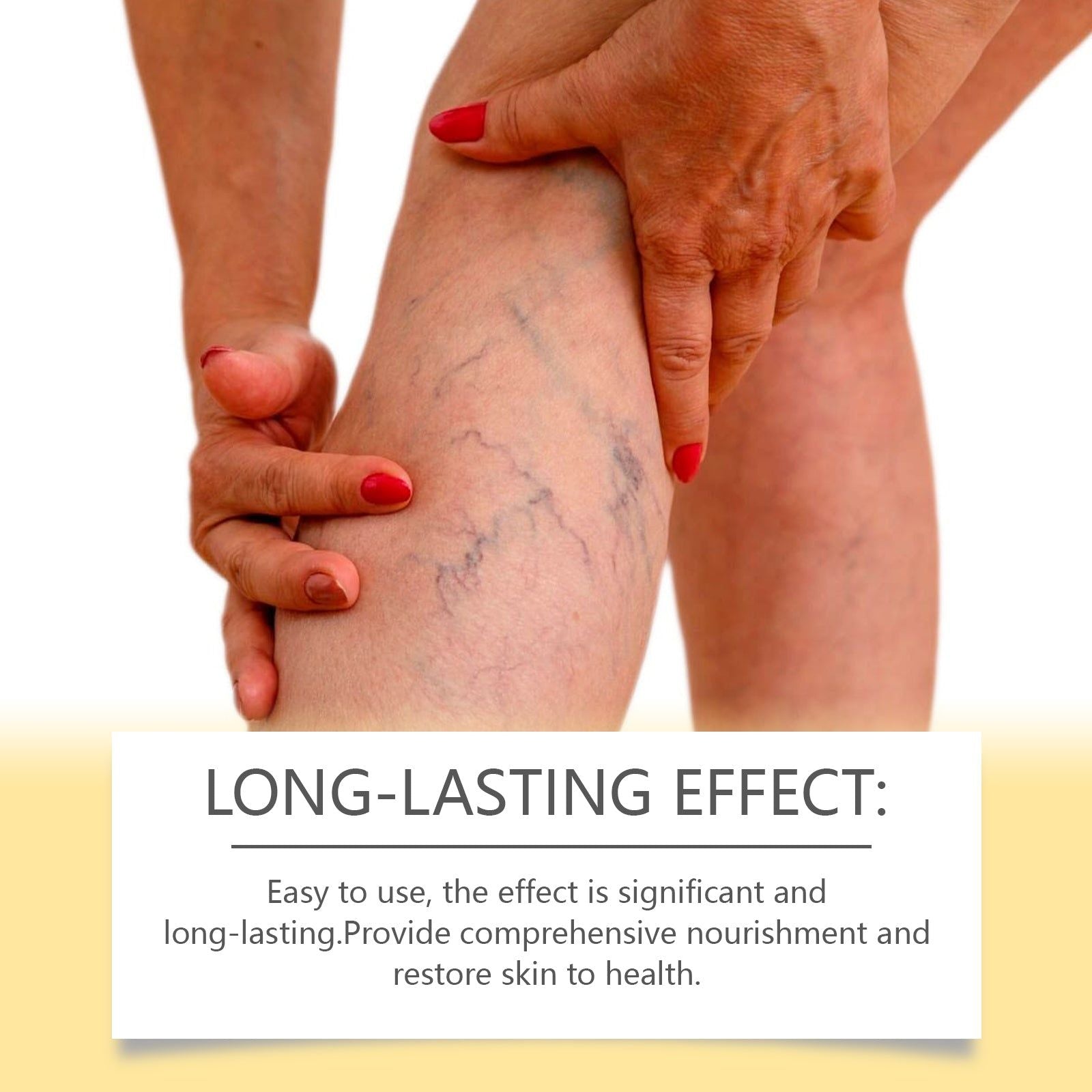 Bee Venom Vein Repair Cream, Leg Fatigue Relief, Circulation Boost, Natural Plant Extracts ,100g