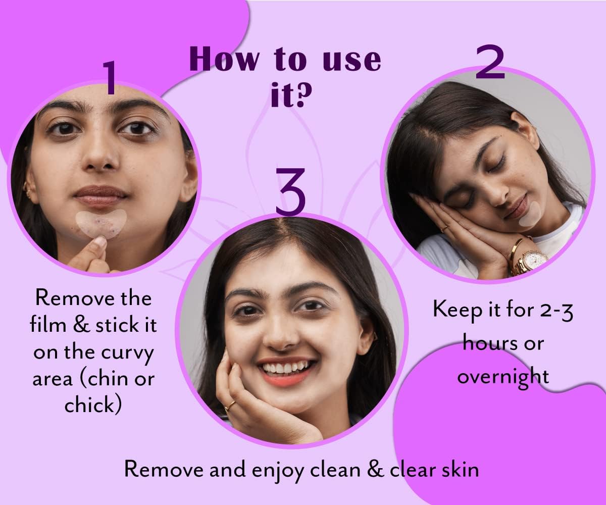 Urban Yog Acne Curvy Pimple Patch - Invisible Facial Stickers cover with 100% Hydrocolloid, Pimple/Acne Absorbing patch