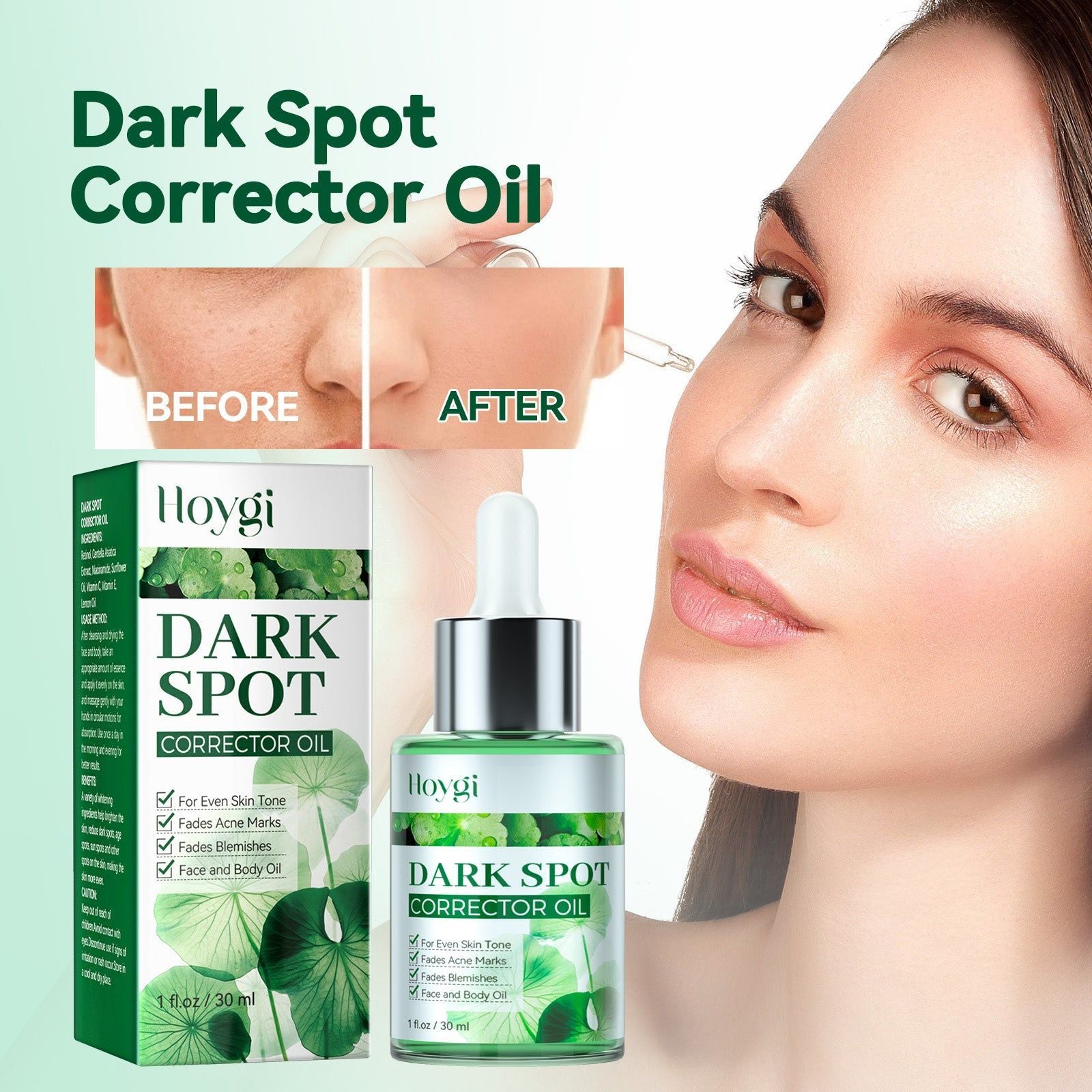 Dark Spot Corrector Serum, Brighten Skin, Fade Age & Sun Spots, Hydrating, Fast Results ,30ml