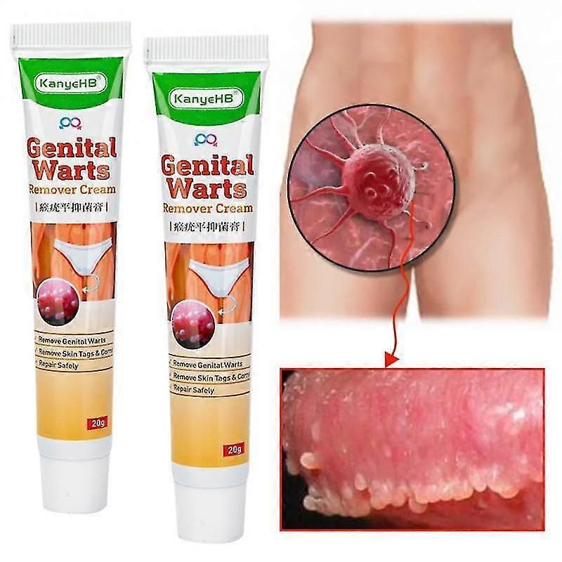 20g Genital Wart Remover Ointment Vulva Herpes Condyloma Acuminatum Condyloma Treat Cream Papillomas Skin Tag Painless Remover for Skin Care_JSCO