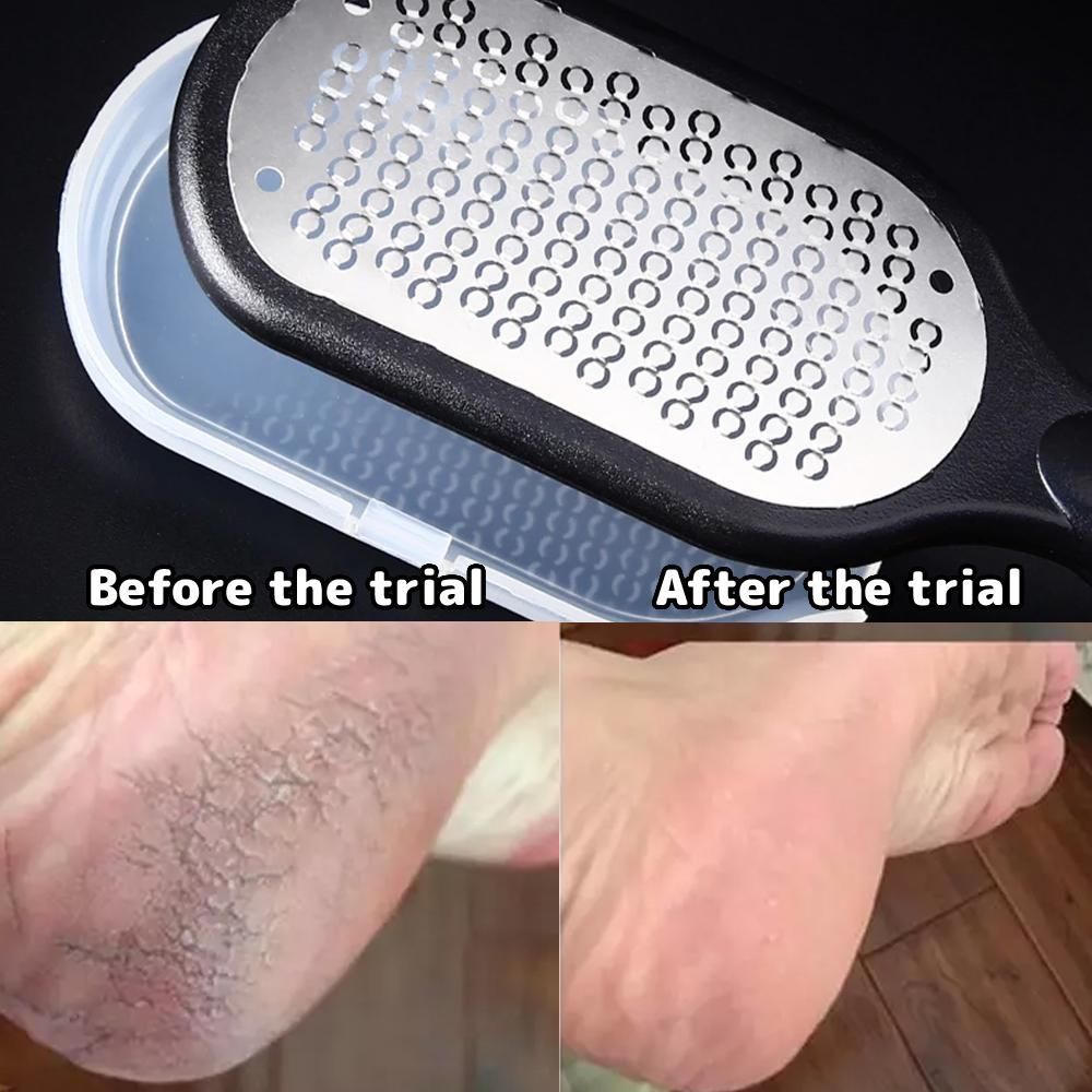 Foot Rubbing Board Dead Skin Callus Removal Foot File Scruper Foot Pedicure Tool