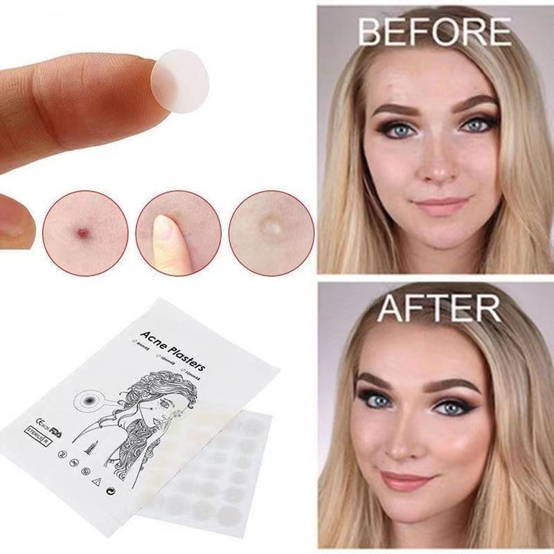 36 pcs Acne Patch Dots Hydrocolloid Invisible Acne Stickers Pimple Zits Remover Patches