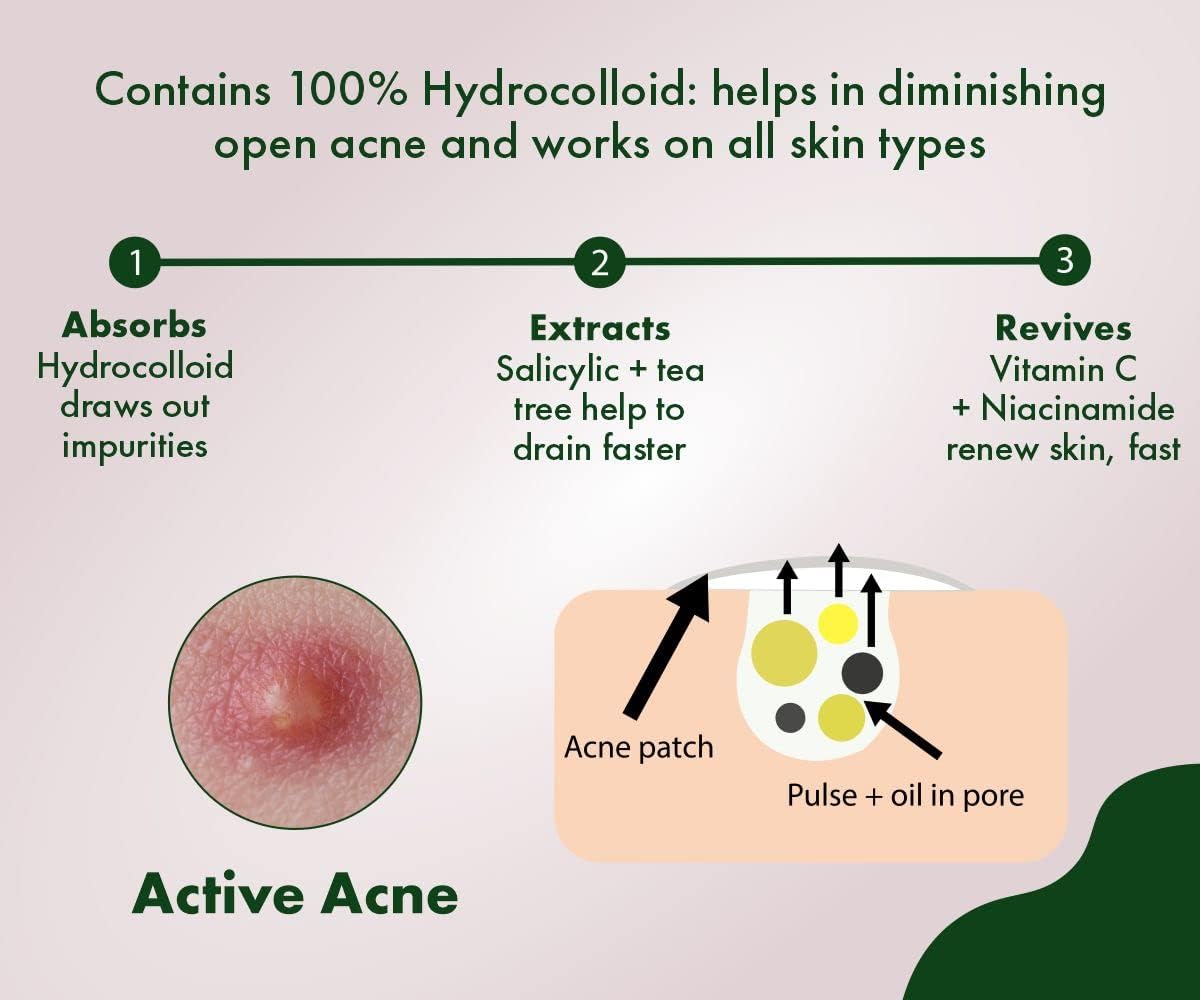 Urban Yog Acne Pimple Patch - 36 Invisible Facial Stickers