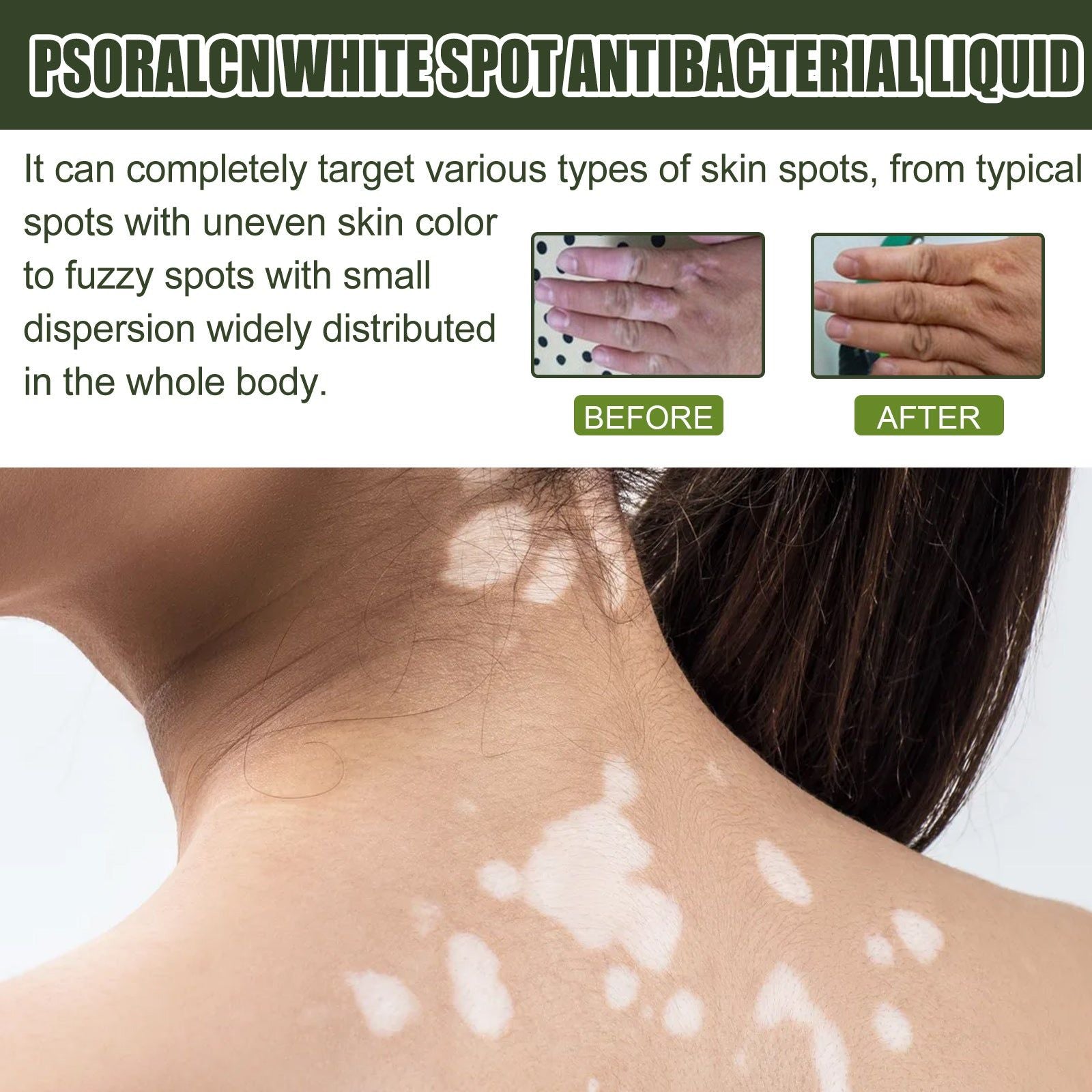 Brighten Skin and Reduce White Spots, Repair Pigmentation, Moisturizing Serum ,30ml