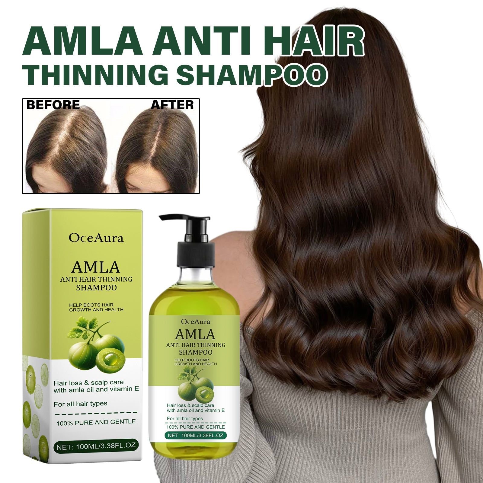 Amla Hair Care Shampoo for Thinning Hair, Nourishing, Strengthening, and Volumizing ,100ml