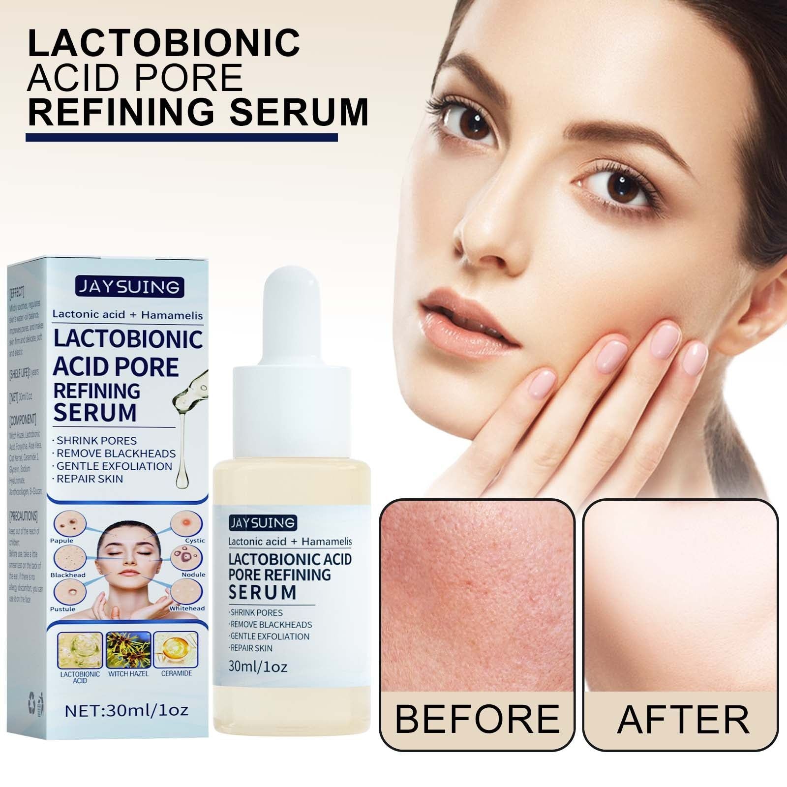 Deep Cleanse Gentle Exfoliation Lactose Solution for Blackheads Pore Shrinking ,30ml