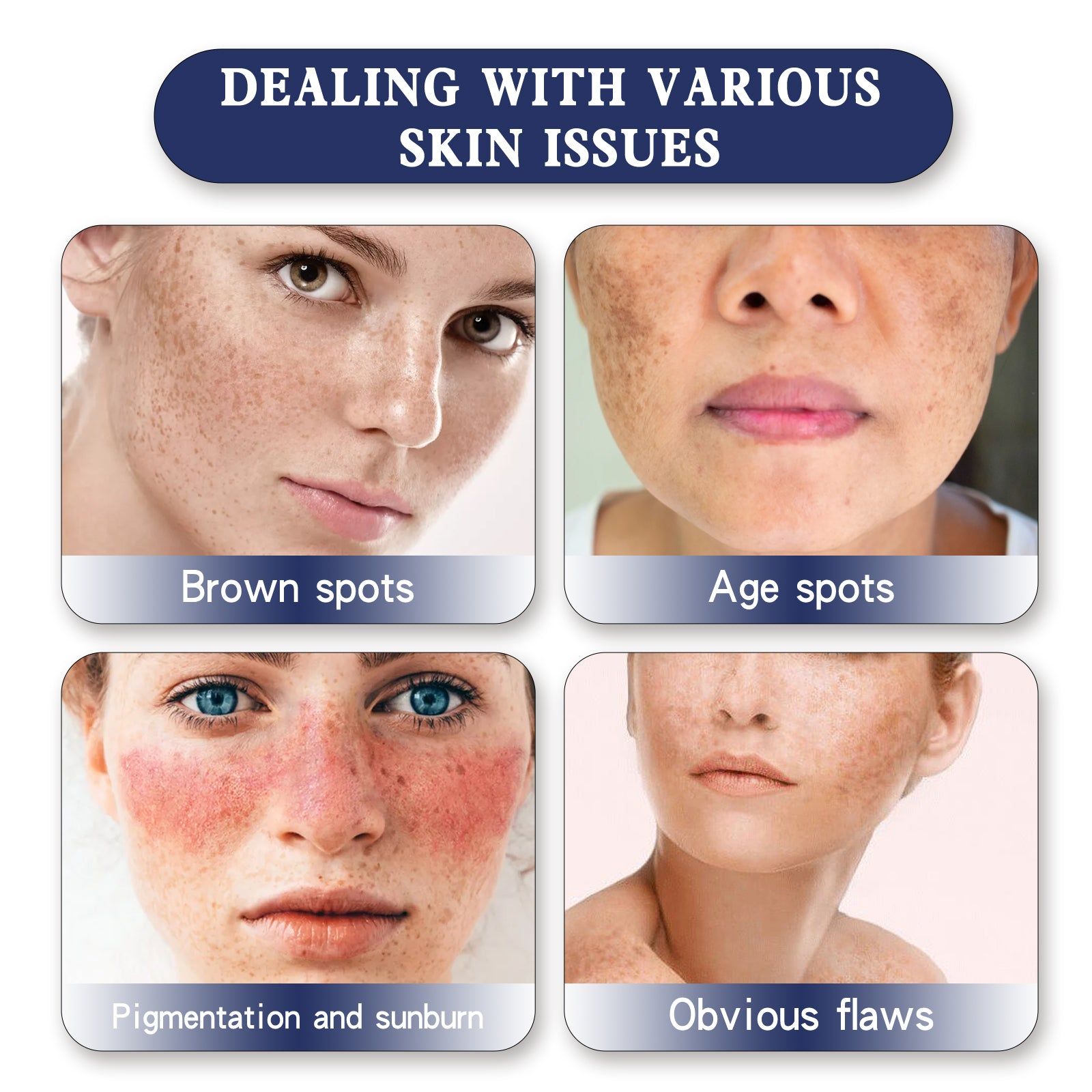 Brightening Skin Cream, Spot Whitening, Hydrating, Anti-Pigmentation, Glowing Complexion ,100g