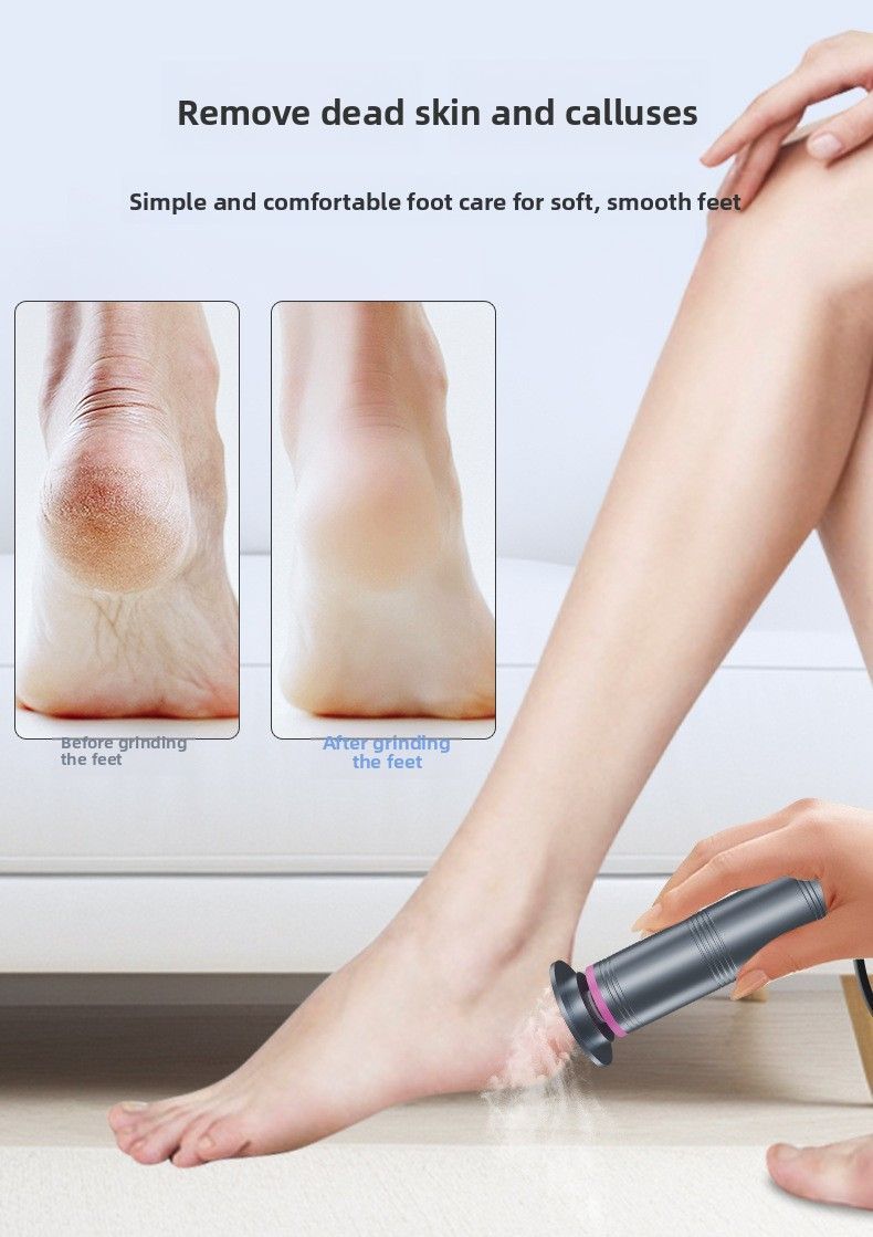 USB Foot Callus Remover for Smooth Feet