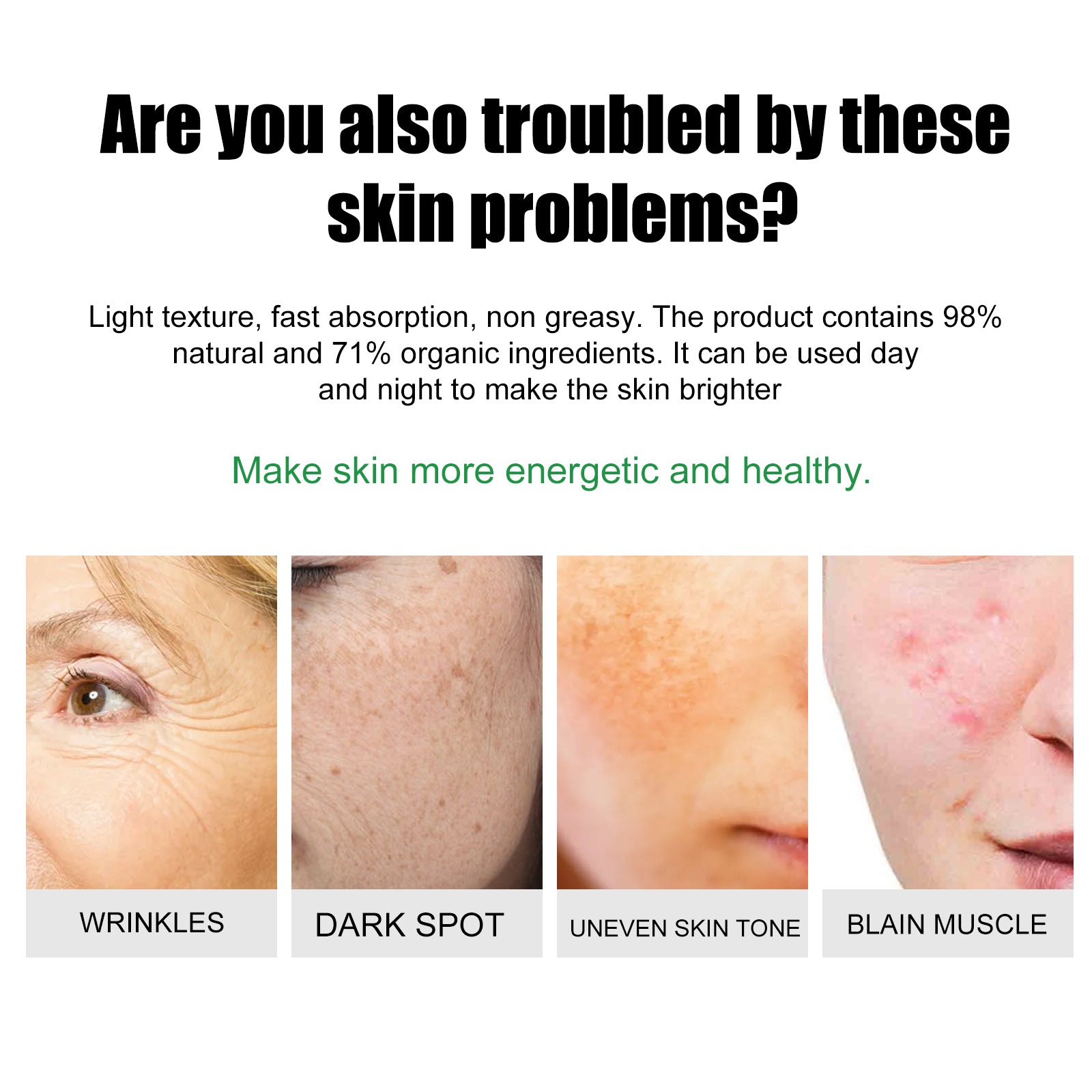Clear Acne Spots Fast, Brighten Skin, Moisturize, Reduce Acne and Pores ,20g