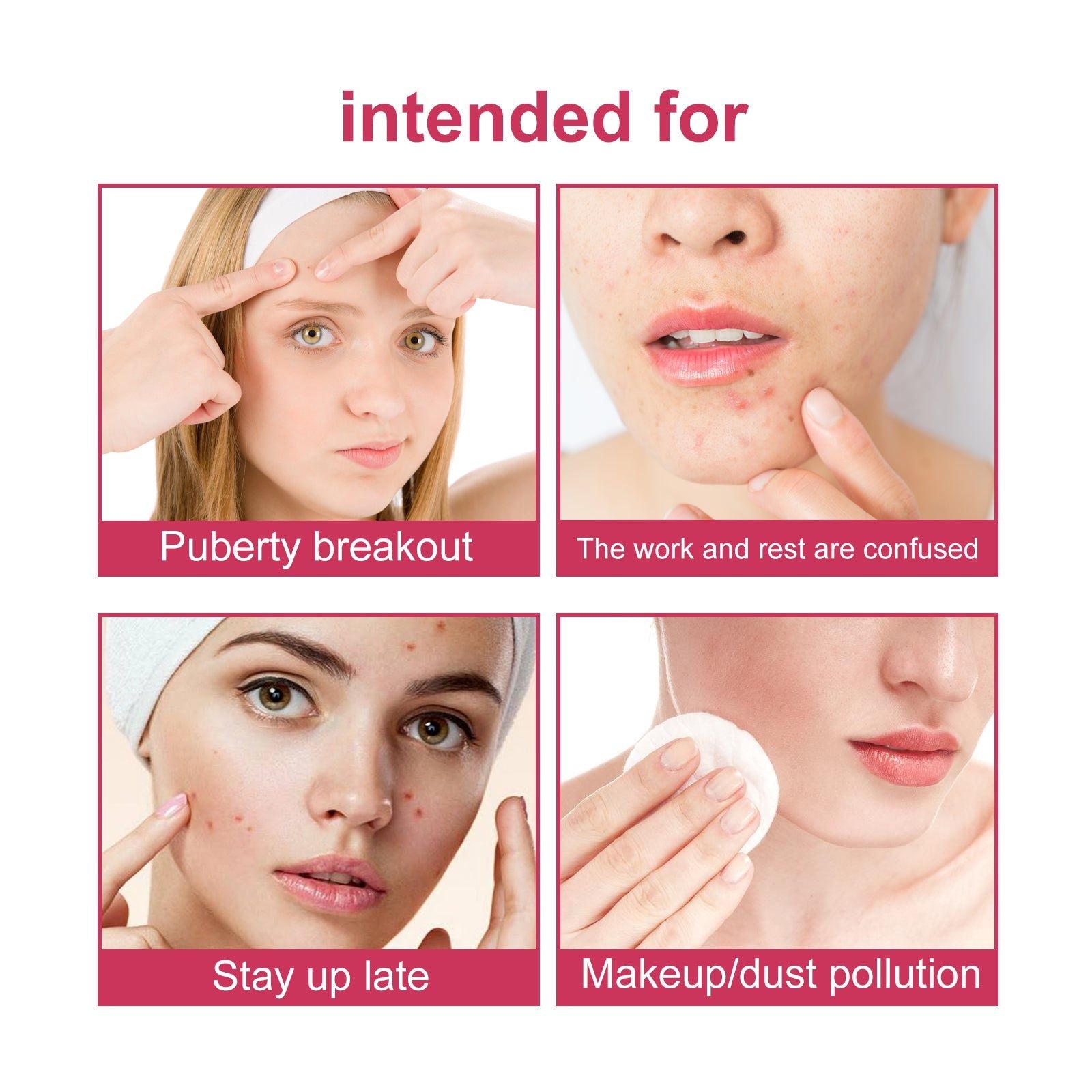 Clear Acne Marks Fast, Hydrating, Pimple Patches for Spot Healing, Acne Scar Treatment ,144pcs