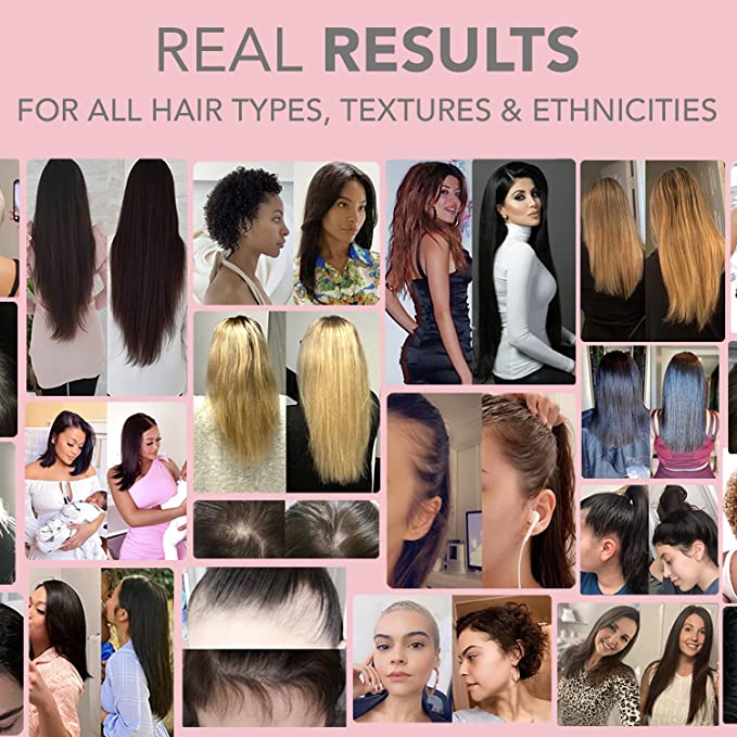 HAIRtamin Mom فيتامينات طبيعية نباتية متعددة للأمهات الحوامل تحتوي على البيوتين والبروبيوتيك وفيتامين B-6 والحديد، الأفضل بعد الولادة