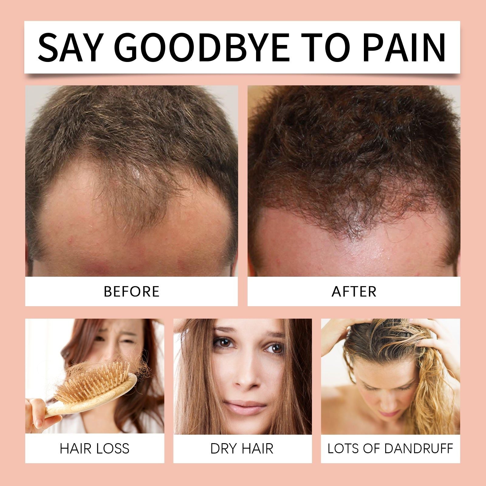 10 Min Superfood Hair Mask, Nourishing Hydrating Repair for Damaged Hair, Glossy Smooth Oil Control ,100g