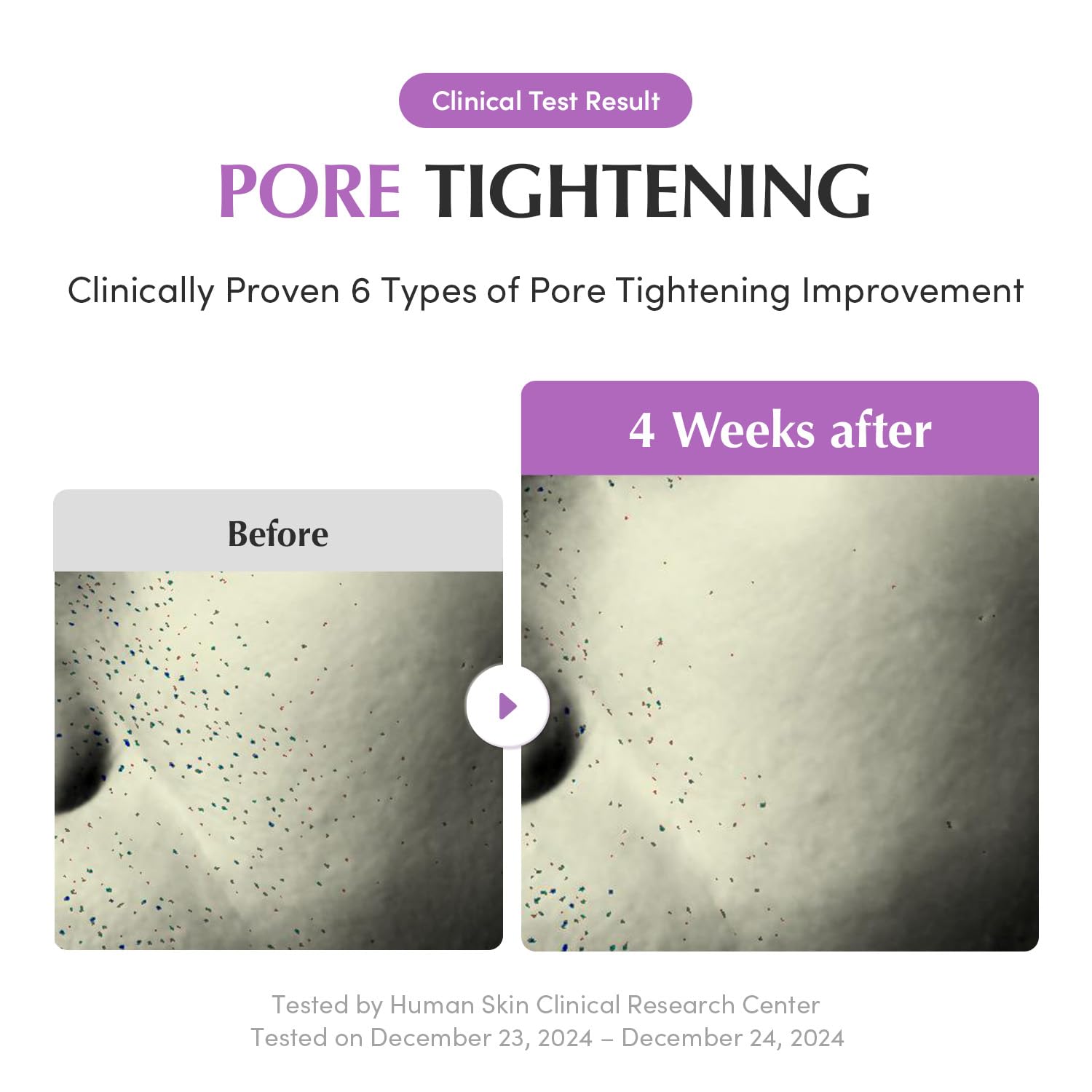 مصل تقليل المسام Eqqualberry Purple Pdrn 30 مل