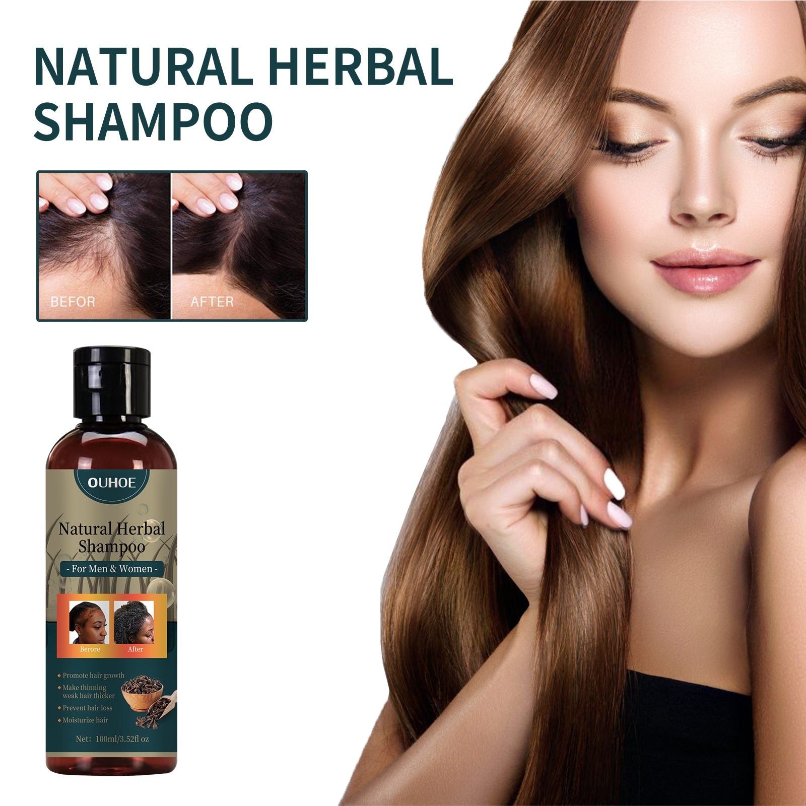 Prevent Hair Loss and Moisturize Hair, Deep Cleansing Scalp Shampoo for Thicker, Shinier Hair ,100ml