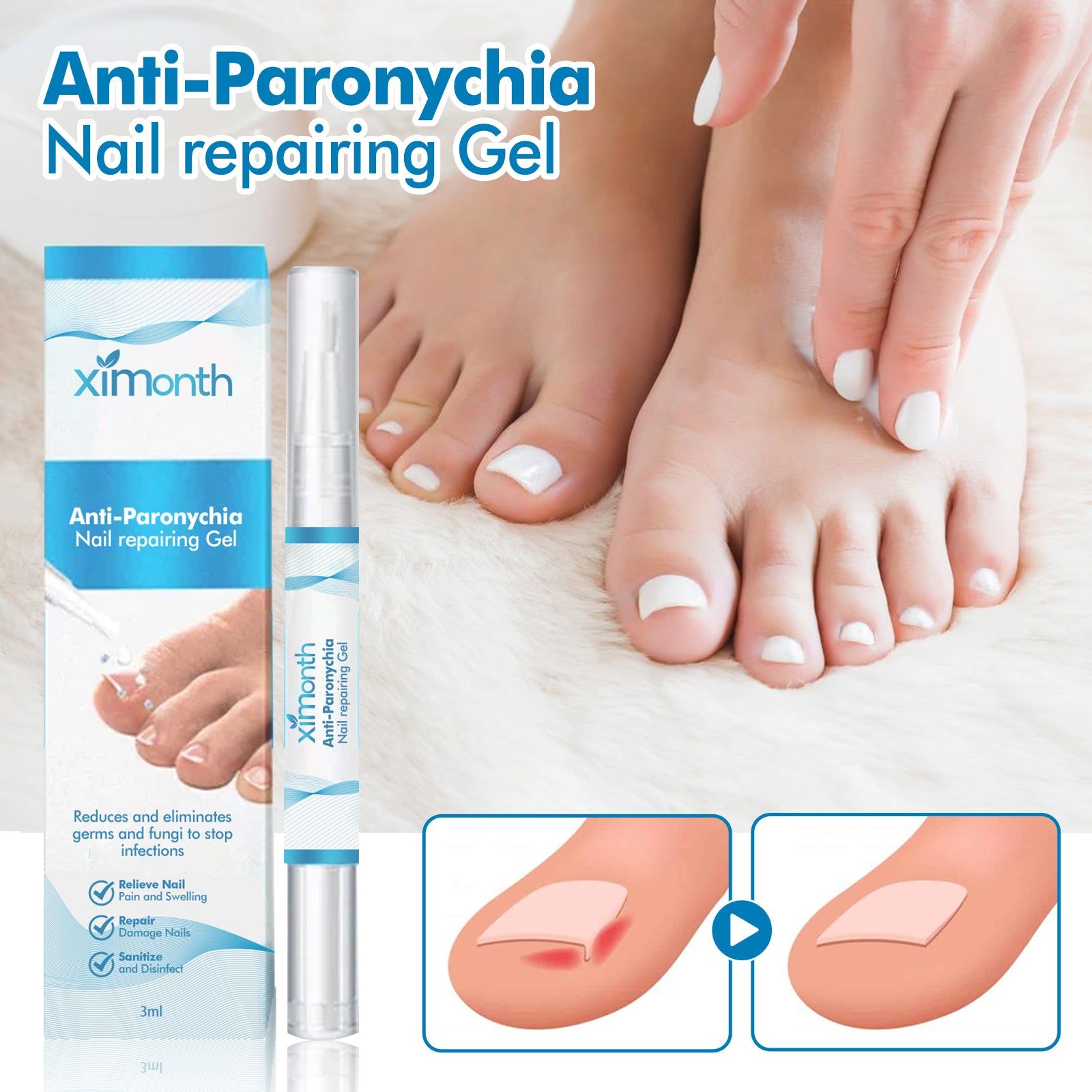 Anti-Paronychia Nail Repair Gel, Fast Pain Relief, Fungal & Bacterial Care, Nail Strengthening, Healthy Nail Care ,3ml