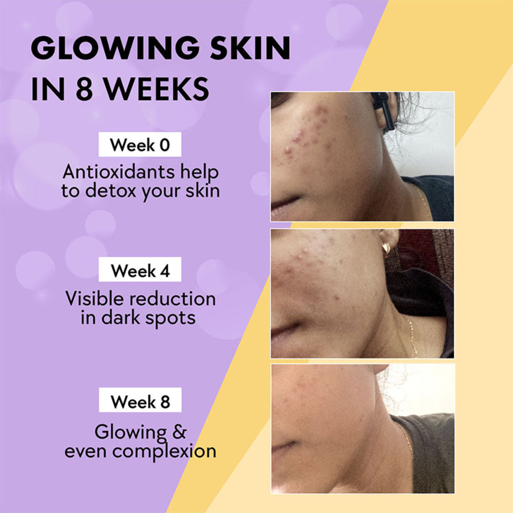 Chicnutrix Glow Black Currant 20 tablet