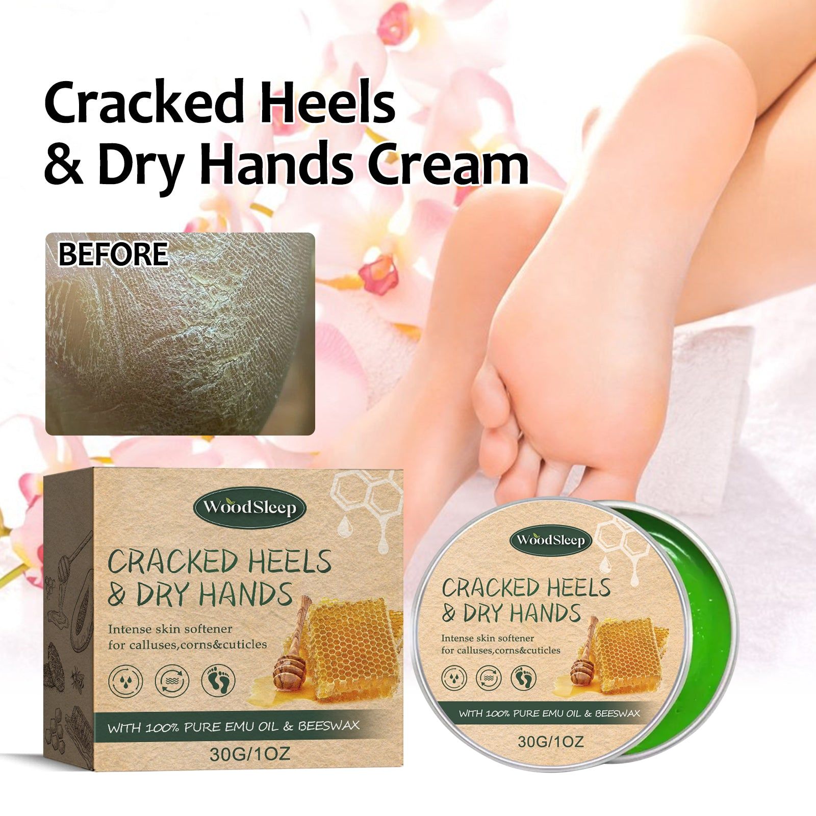 Ultimate Anti-Crack Hand and Foot Cream, Deep Moisturizer for Dry Skin, Repair & Nourish ,30g