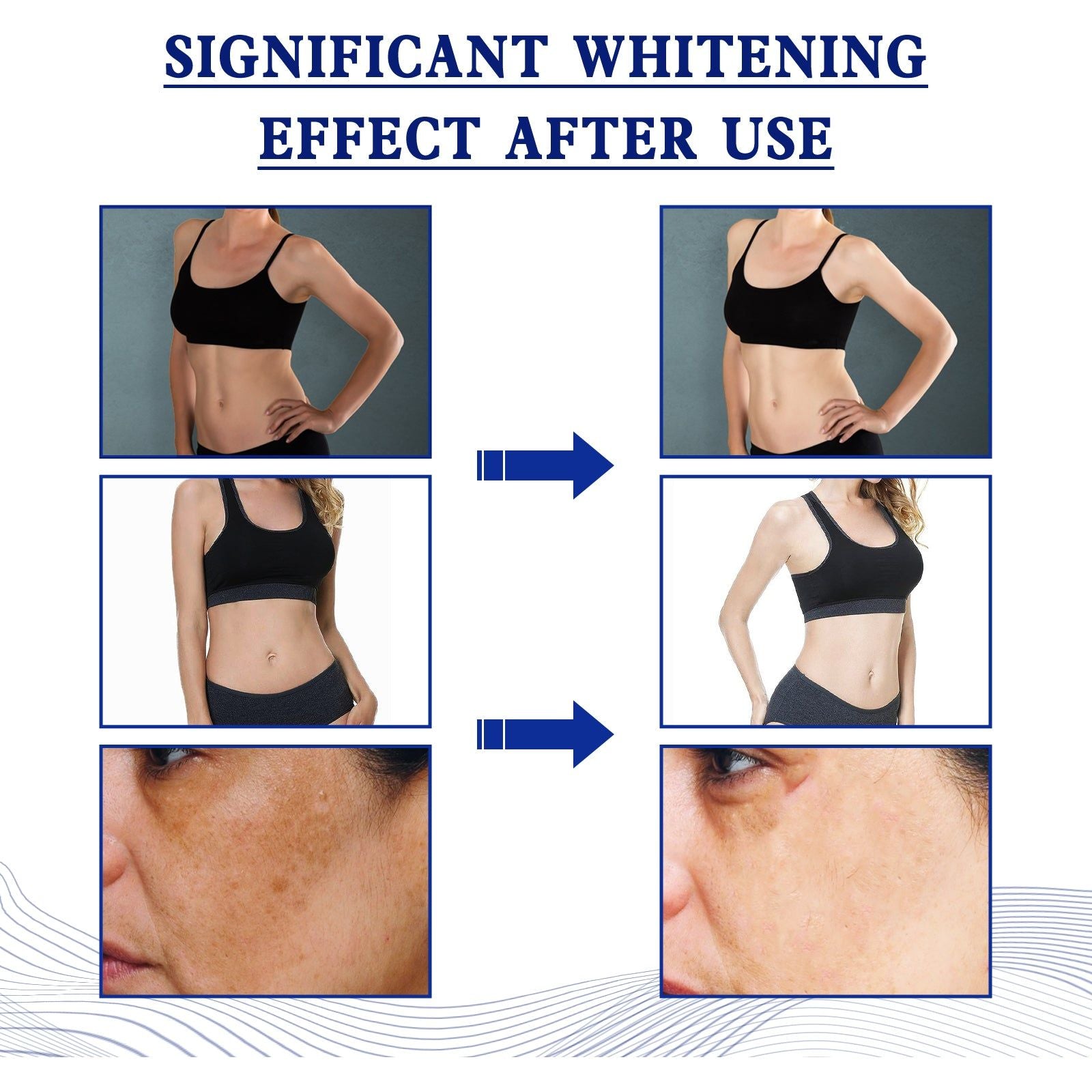 Brighten Skin with Body Exfoliating Niacinamide Gel, Fade Dark Spots, Deep Clean ,100g