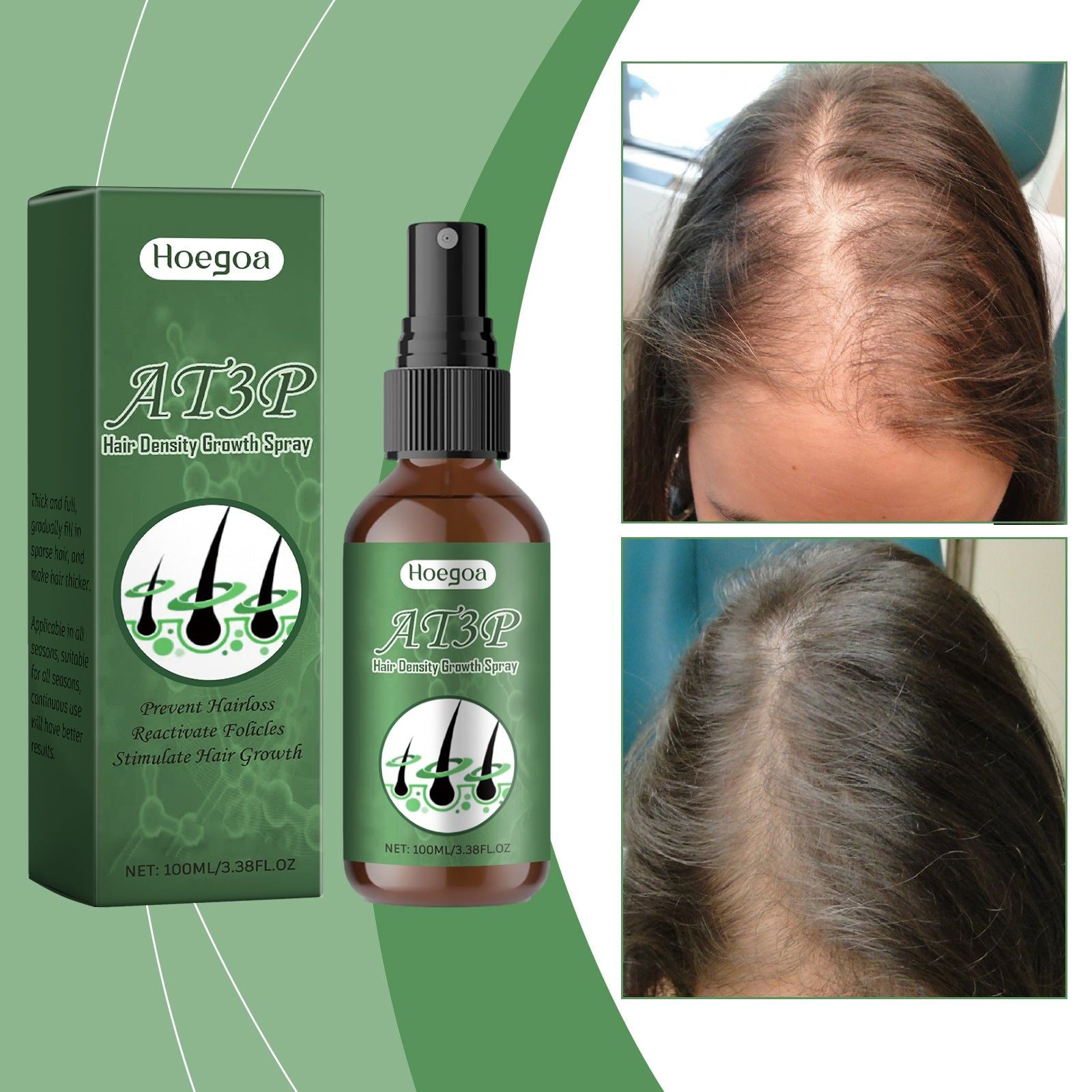 Close Hair Spray, Repair Dry, Moisturize, Thick, Smooth, Glossy Hair Treatment ,100ml
