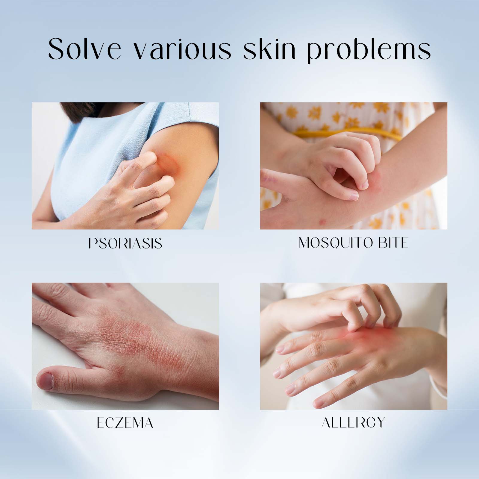 Breaking Itch King Psoriasis Cream, Fast Relief for Red, Itchy, and Irritated Skin ,20g