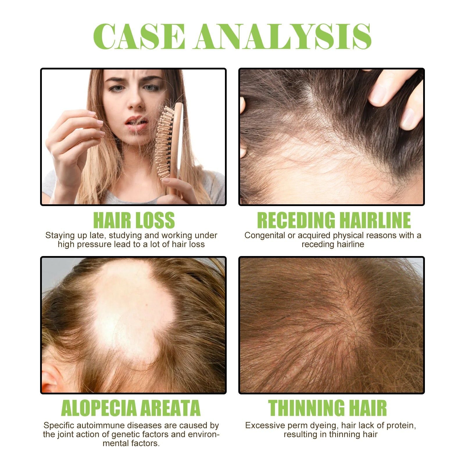 شامبو العناية بفروة الرأس بالزنجبيل لتجديد حيوية الشعر وتقويته وتغذيته وجعله أكثر كثافة، 10 قطع