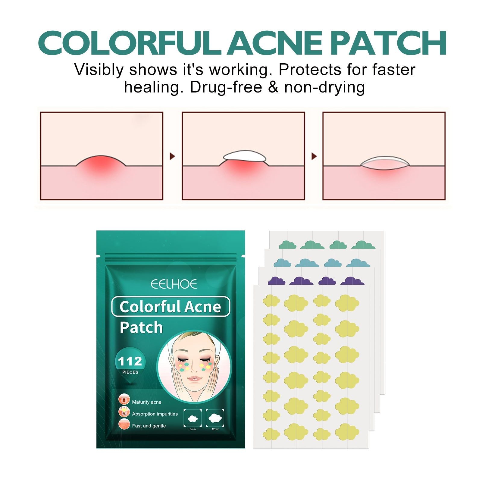 Colorful Acne Patch, Salicylic Acid, Pore Cleanser, Facial Treatment, Clear Skin ,144pieces