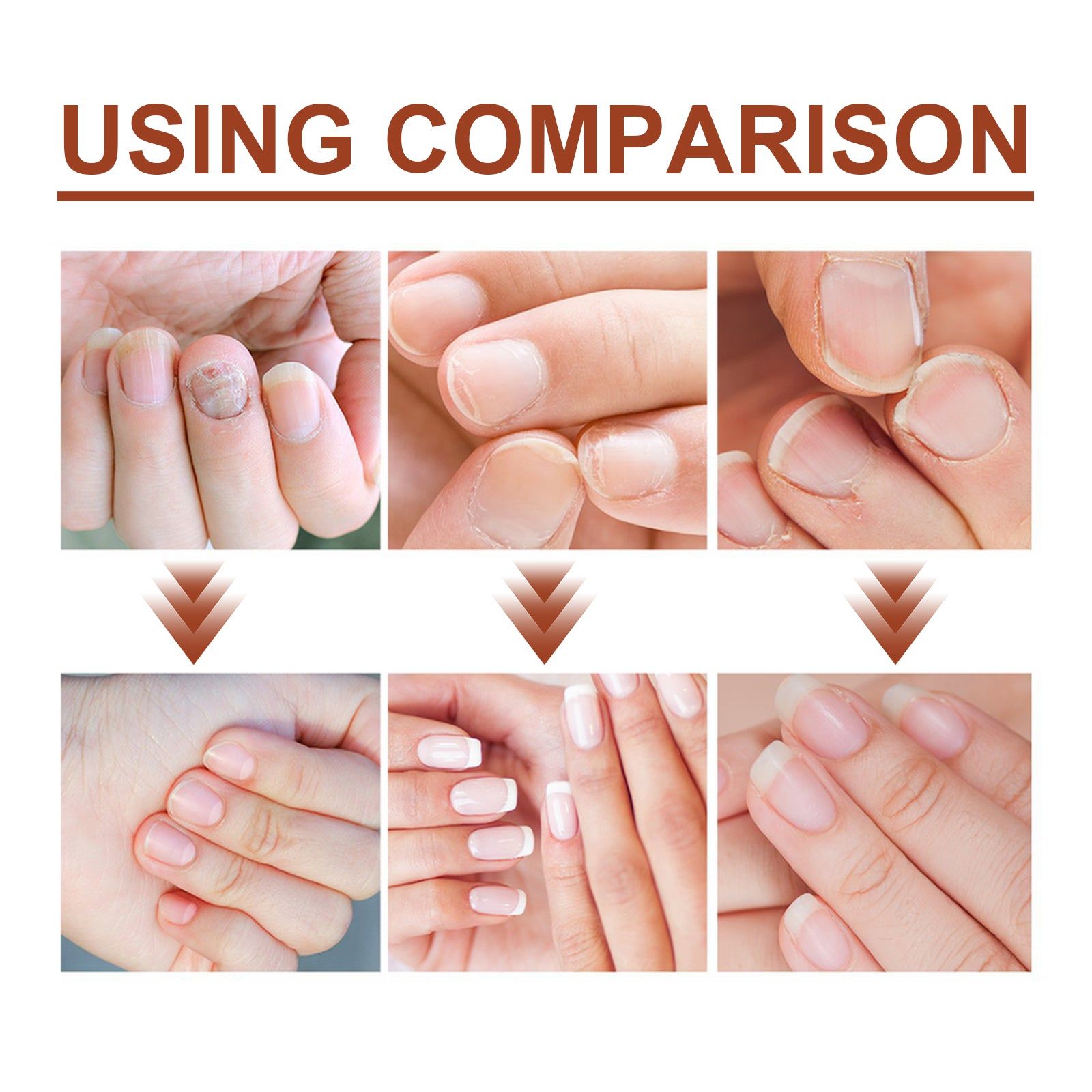 7 Day Nail Care Essence for Manicure, Stronger Nails, Fungal Treatment, Nourishing Serum ,20ml