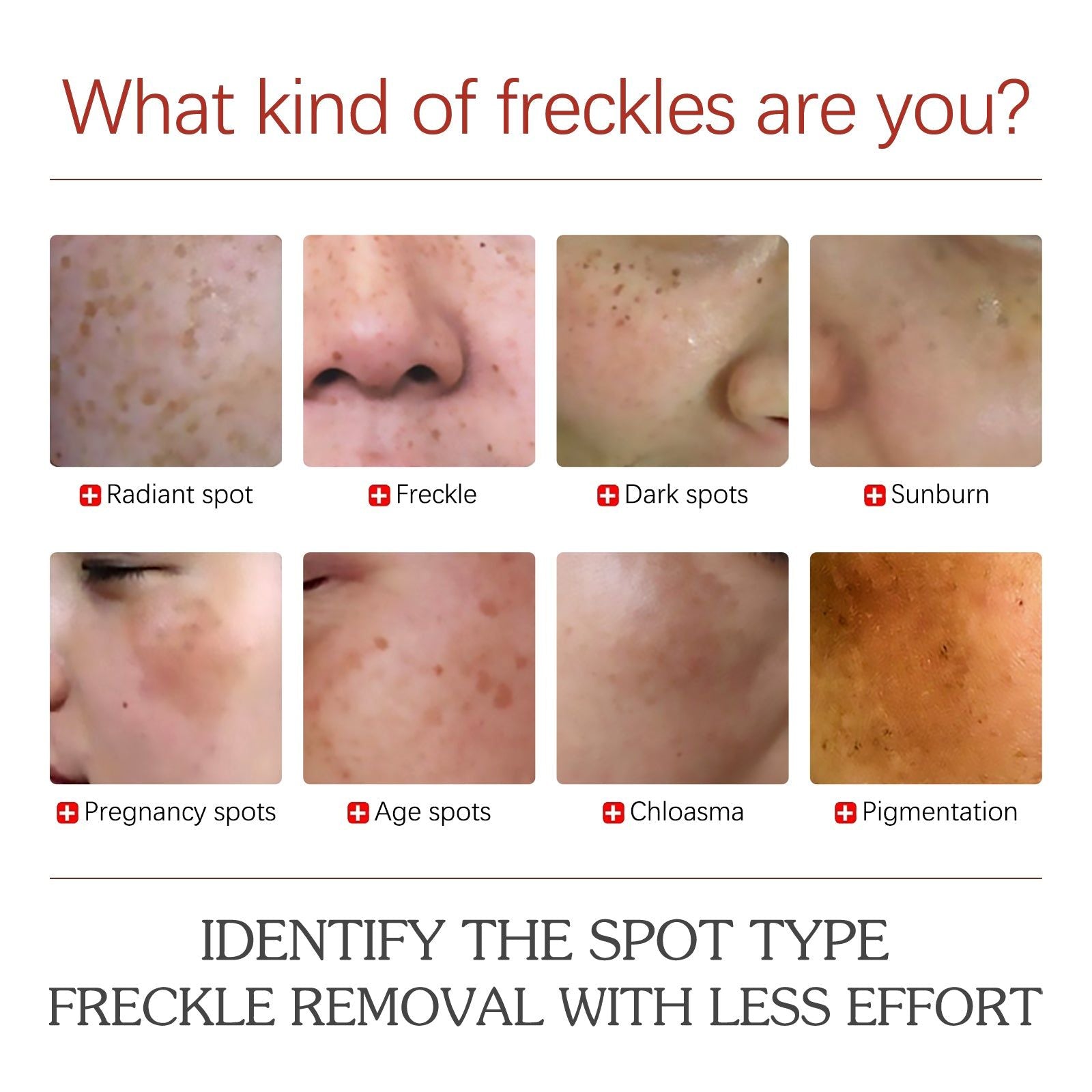 Brighten Skin Fade Dark Spots Melasma Cream, Hydrating, Gentle, Daily Care ,30g