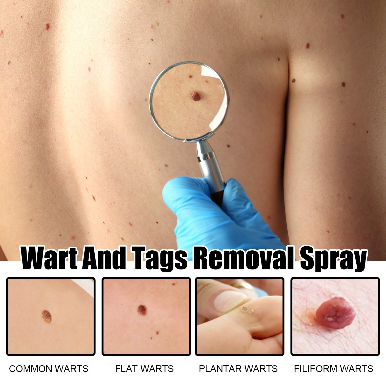 Bee Venom Wart Care Spray, Gentle Skin Tightening, Fast Mole Removal ,20ml
