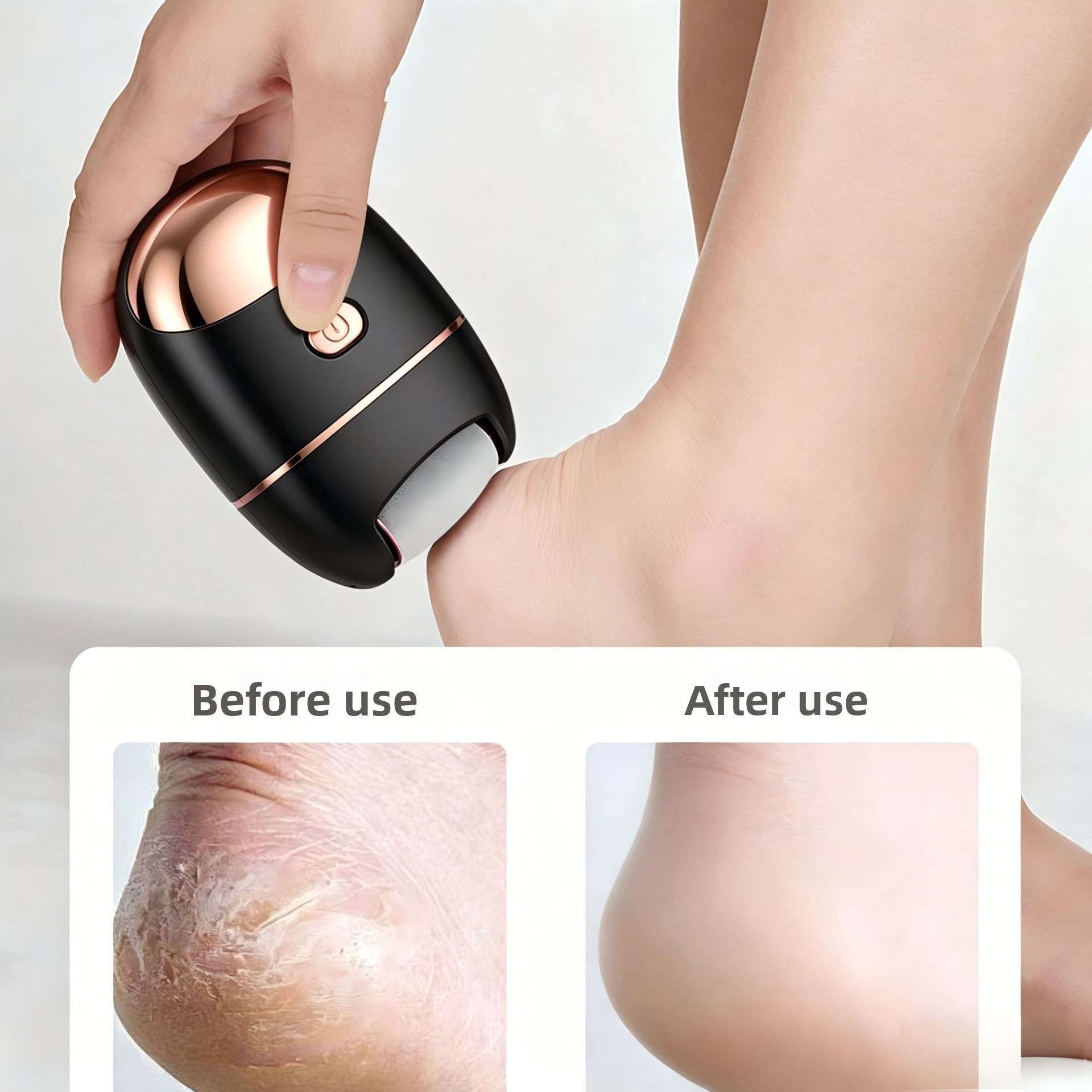 USB Electric Foot Callus Remover for Home & Travel Black