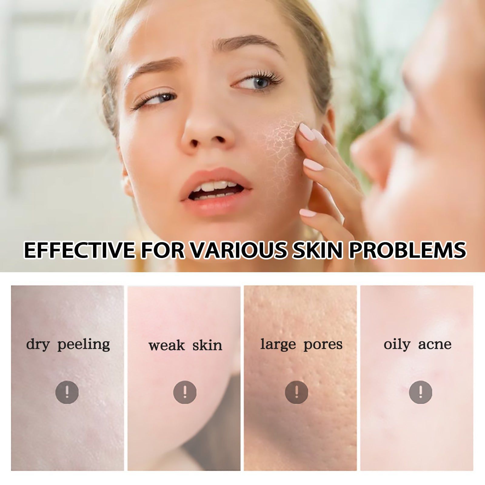 After Sun Repair Cream, Hydrating Moisturizer for Skin, Post Sun Recovery ,50g