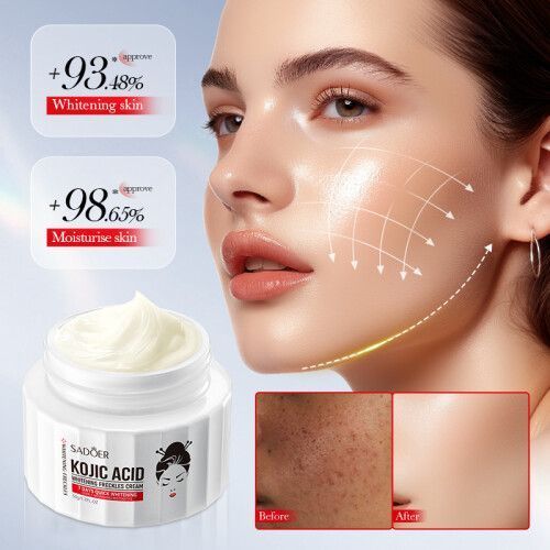 Freckle & Dark Spot Removing Cream with Kojic Acid - 001- SD10407