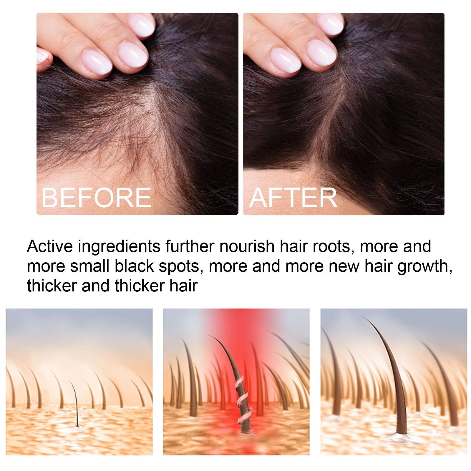 Boost Hair Growth Naturally with Ginger Hair Essence, Moisturizing & Smoothing Treatment ,30ml