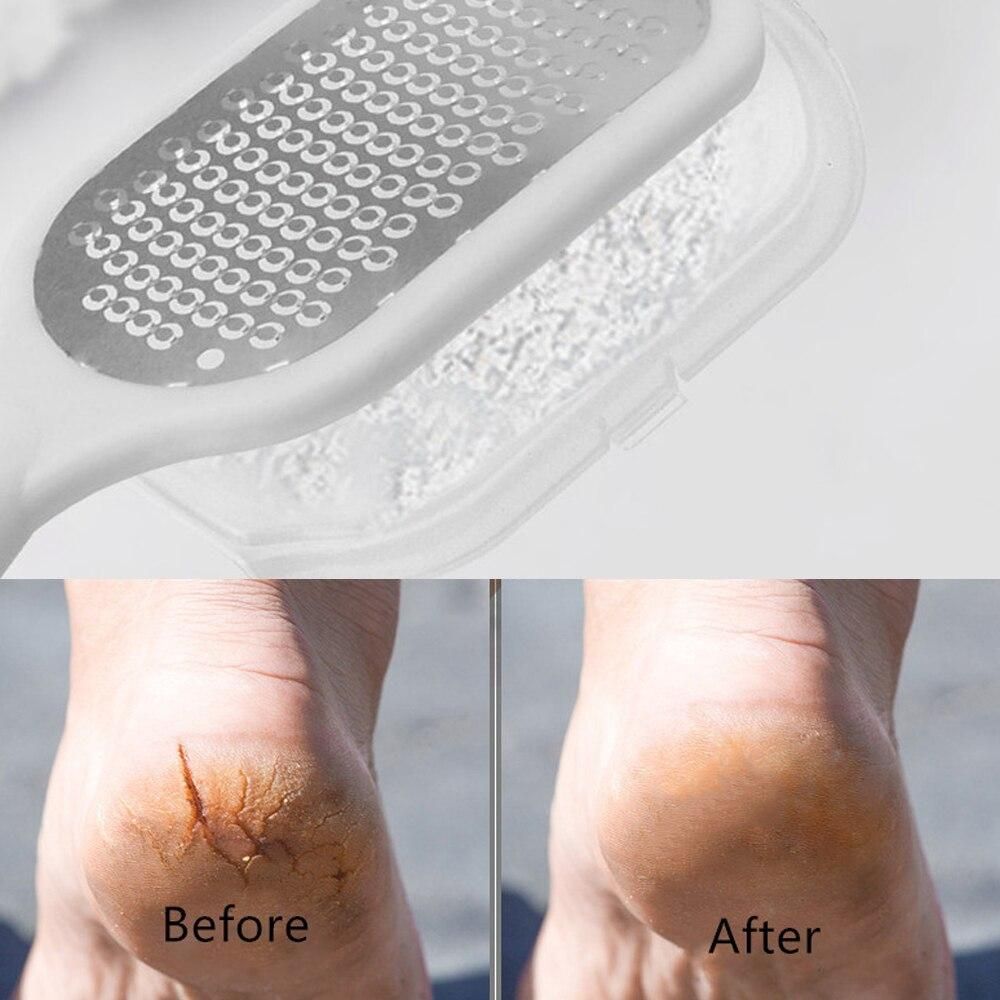 Foot Rubbing Board Dead Skin Callus Removal Foot File Scruper Foot Pedicure Tool