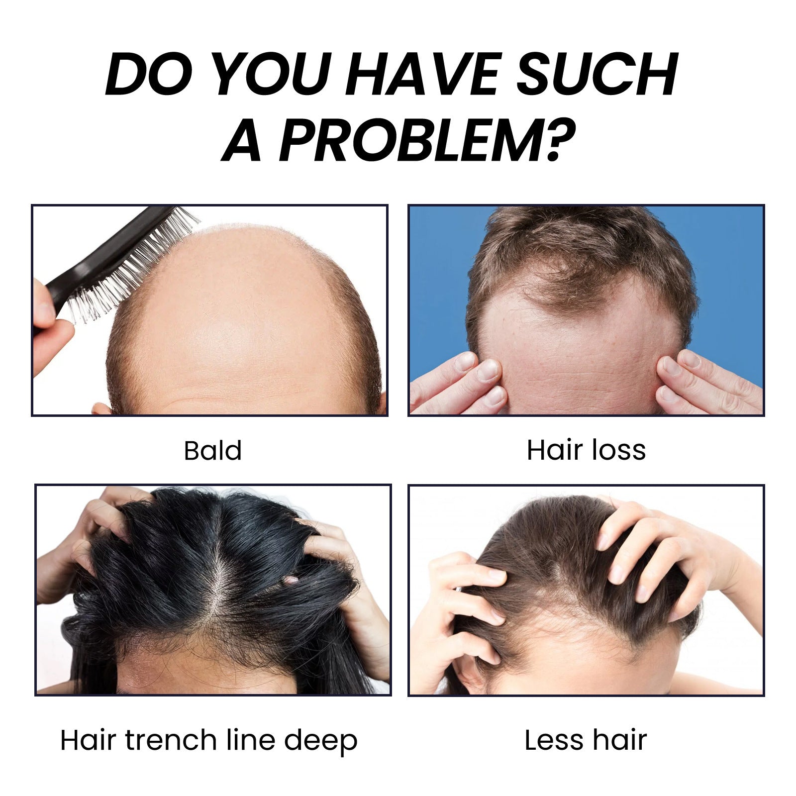 Boost Hair Growth with Ginger & Ginseng, Thicker, Healthier Hair, Hair Loss Prevention ,30ml