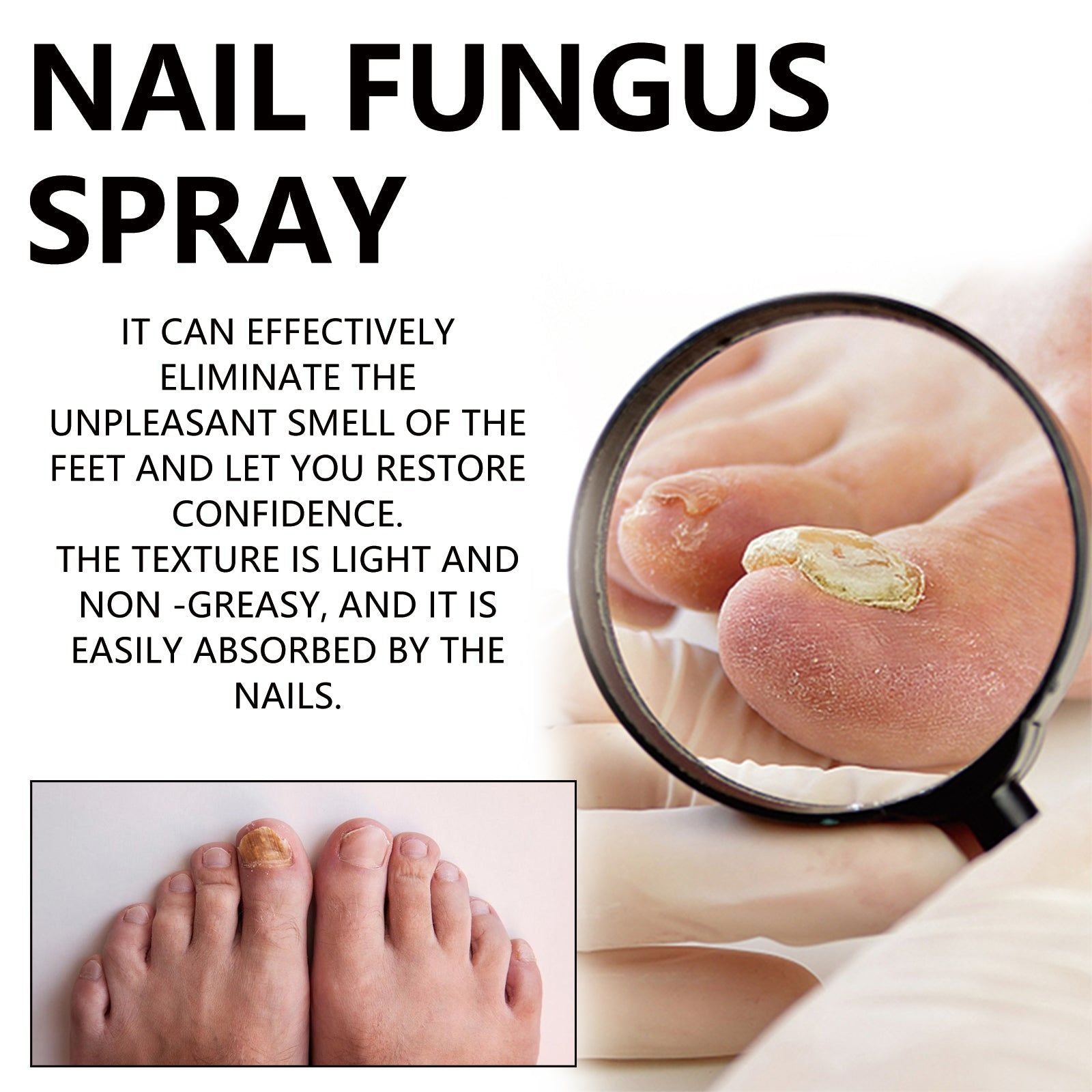 Nail Fungus Spray, Foot Odor Remover, Nail Care, Fungal Infection Treatment, Gray Nails Solution ,100ml