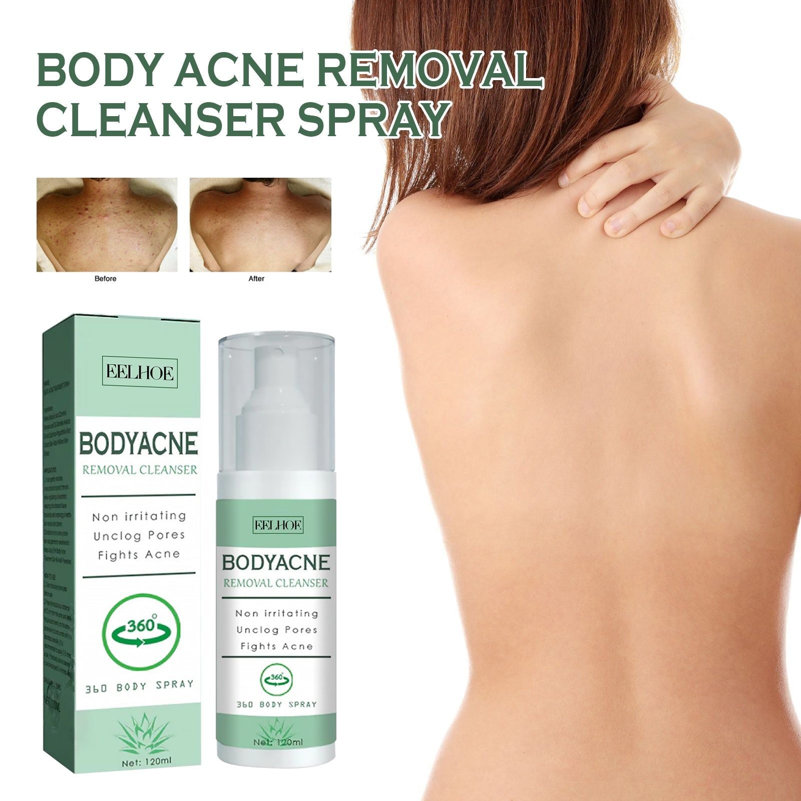 Body Care Spray, Gentle Acne & Moisturizing Mist, Skin Repair, Hydrating, Clear Skin ,120ml