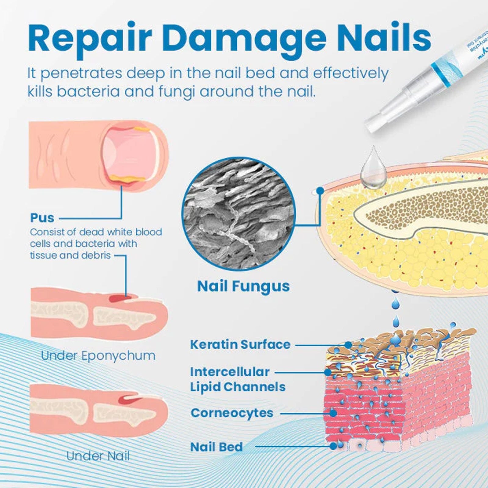 Anti-Paronychia Nail Repair Gel, Fast Pain Relief, Fungal & Bacterial Care, Nail Strengthening, Healthy Nail Care ,3ml