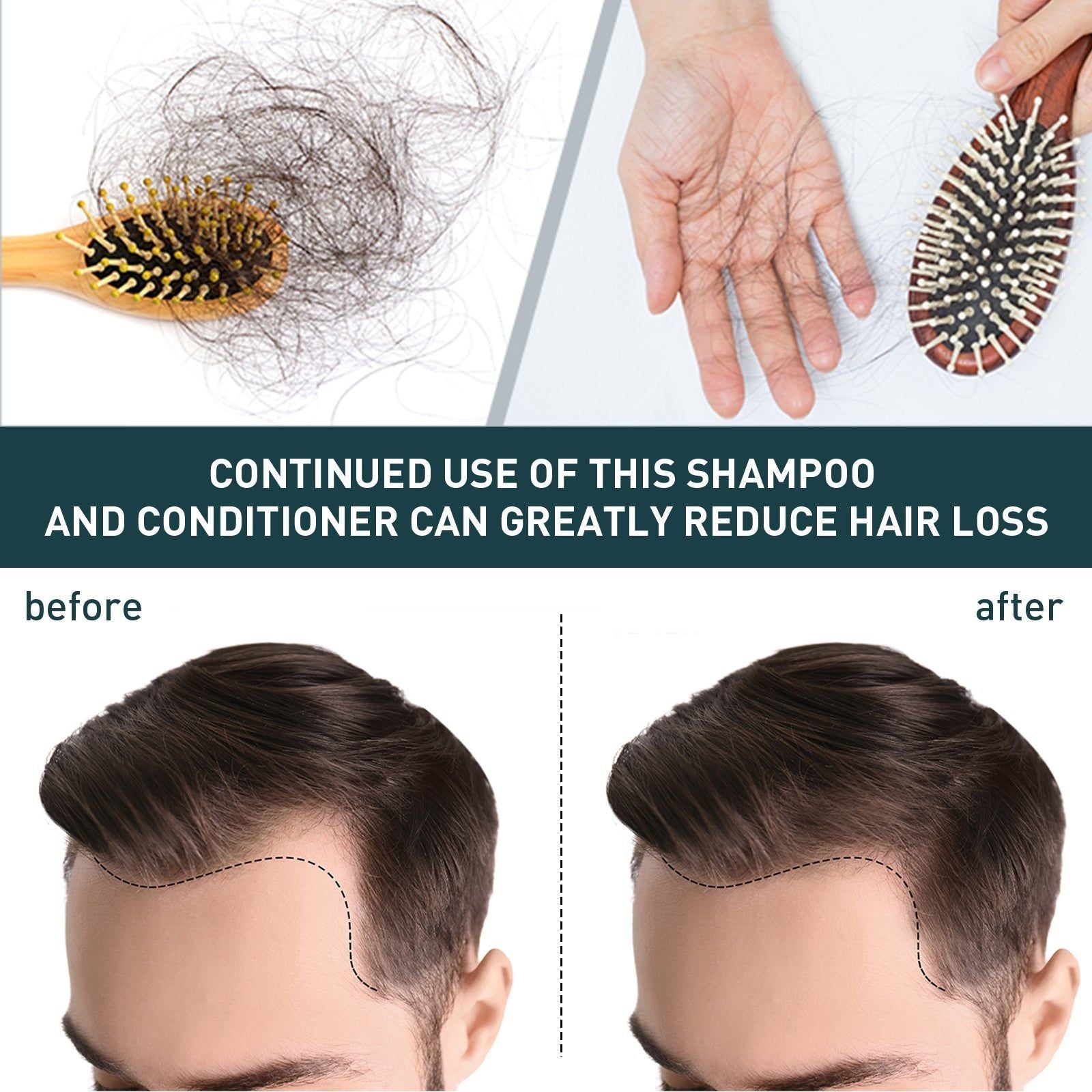 Prevent Hair Loss and Moisturize Hair, Deep Cleansing Scalp Shampoo for Thicker, Shinier Hair ,100ml