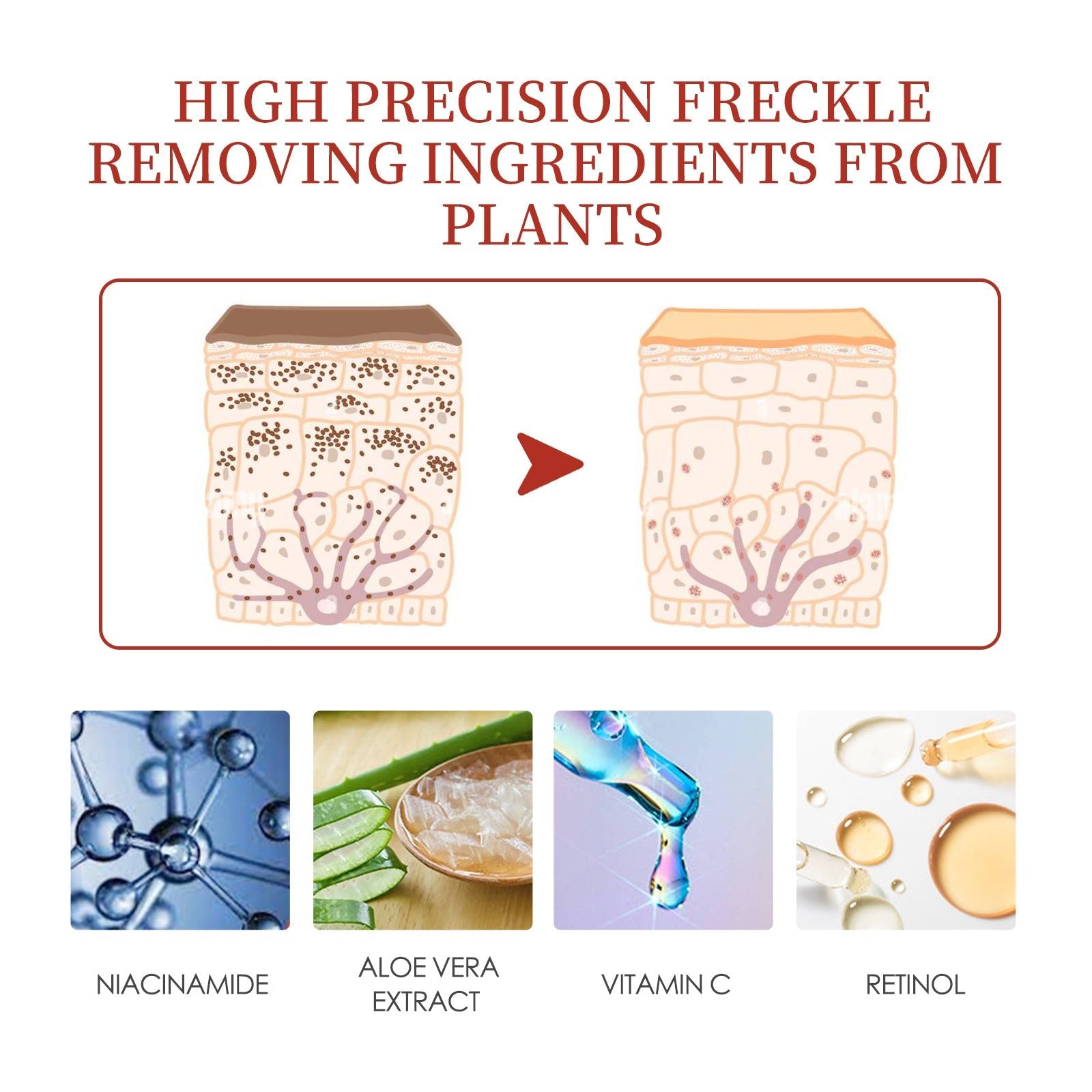 Brighten Skin Fade Dark Spots Melasma Cream, Hydrating, Gentle, Daily Care ,30g
