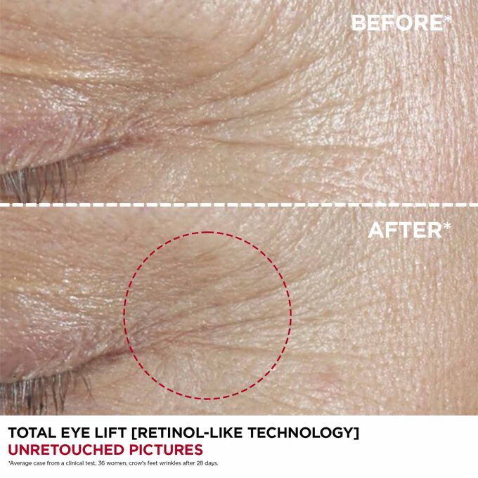 Total Eye Lift 15ml