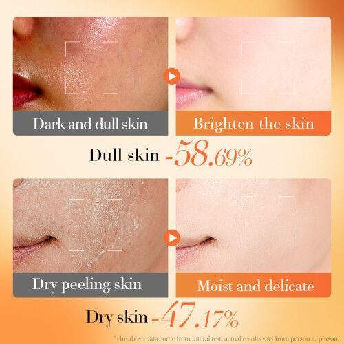 Vitamin E B5 Repairing Face Cream 50g - 001-BQY17925